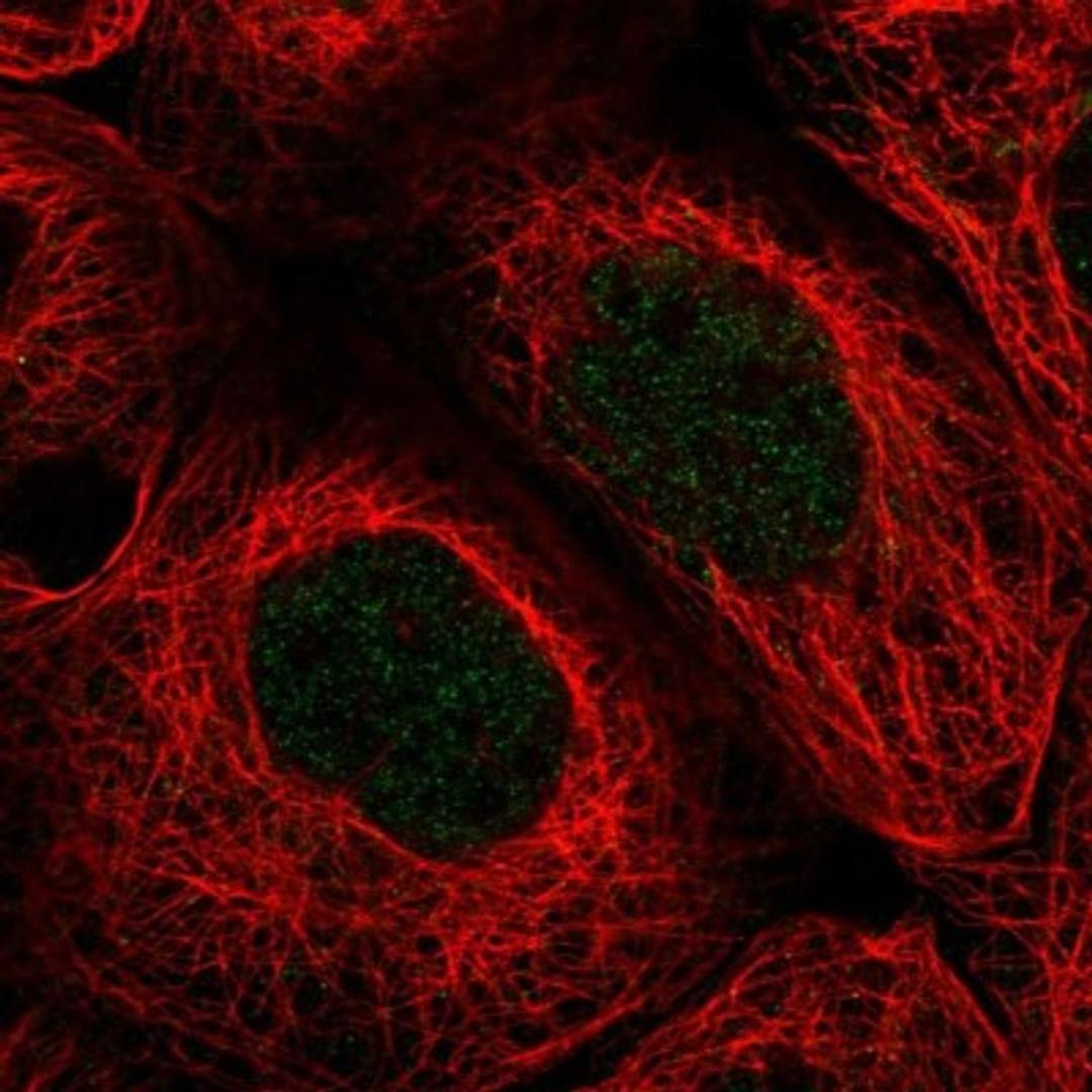 Immunocytochemistry/Immunofluorescence: Pregnancy specific beta 1 glycoprotein 11 Antibody [NBP1-87795] - Staining of human cell line A-431 shows positivity in nucleus but not nucleoli.