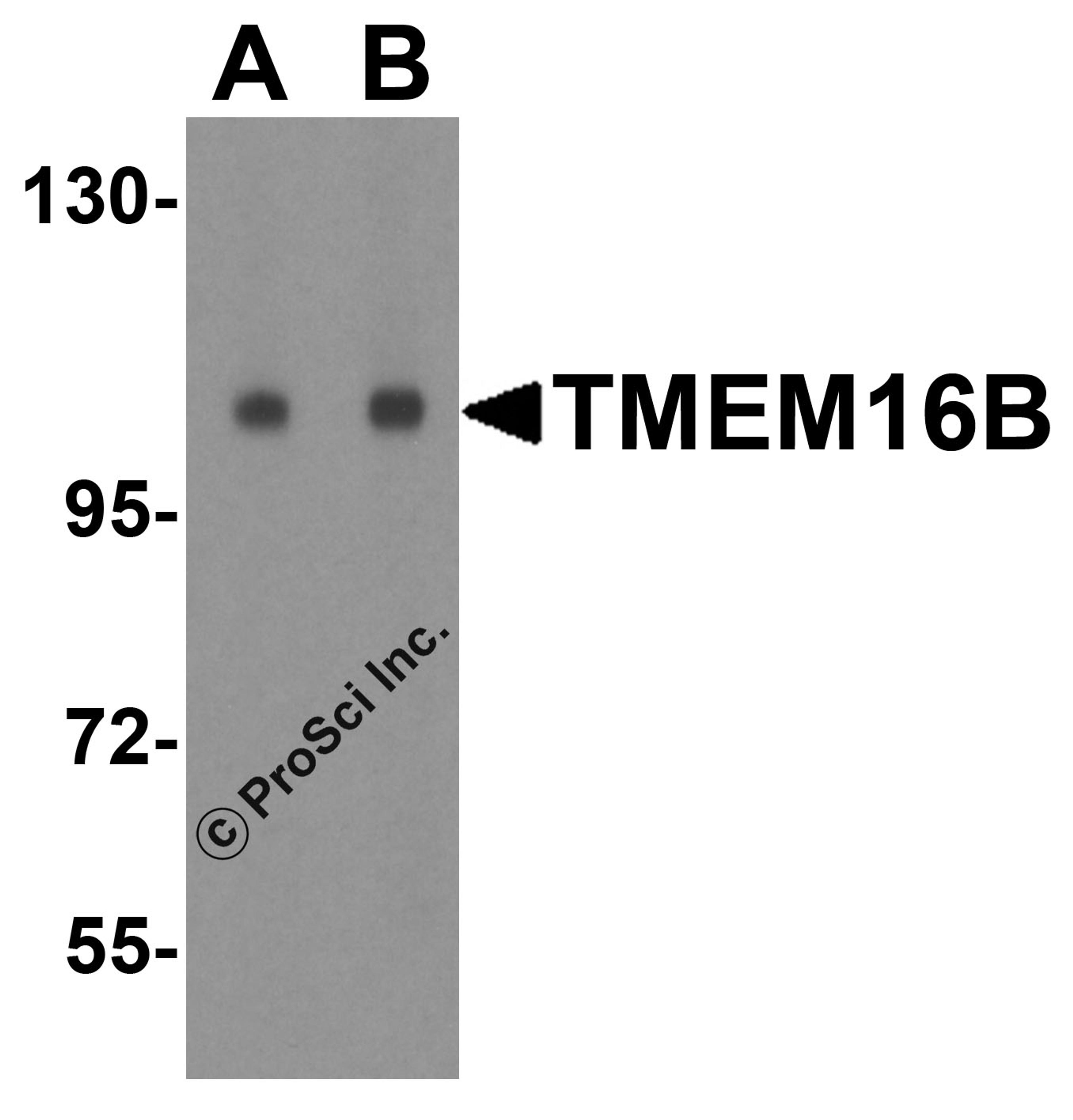Western blot analysis of TMEM16B in human small intestine tissue lysate with TMEM16B antibody at (A) 1 and (B) 2 μg/mL.