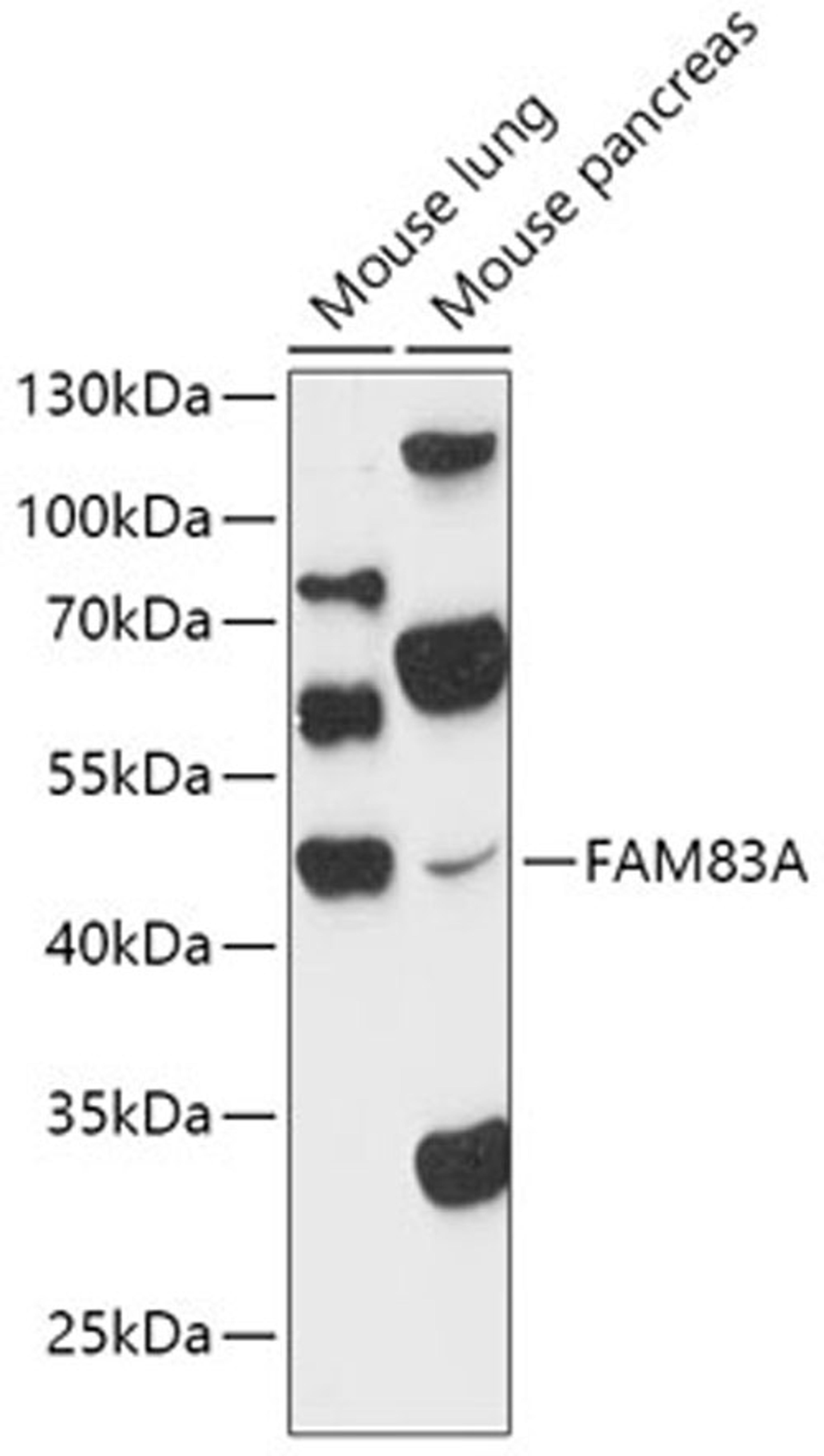 Western blot - FAM83A antibody (A15201)