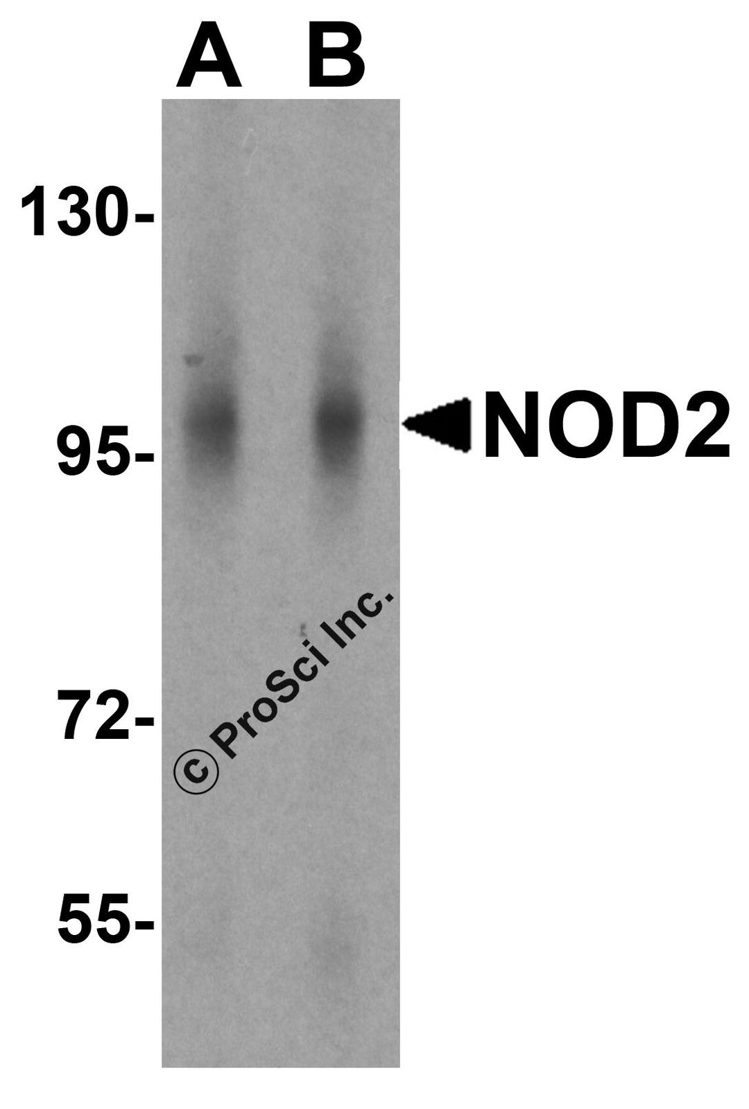 Western blot analysis of NOD2 in human lymph node tissue lysate with NOD2 antibody at (A) 1 and (B) 2 μg/mL.