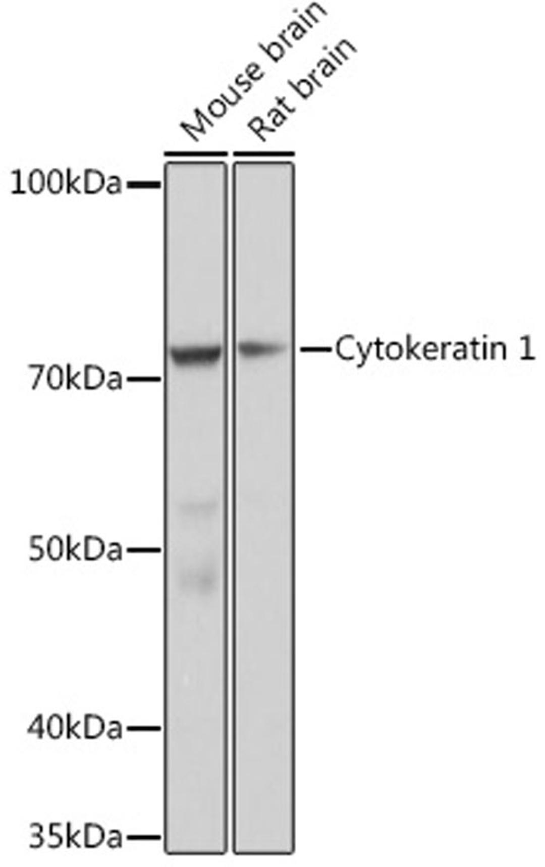 Western blot - Cytokeratin 1 Rabbit mAb (A9776)