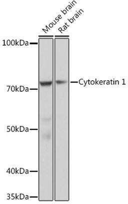 Western blot - Cytokeratin 1 Rabbit mAb (A9776)