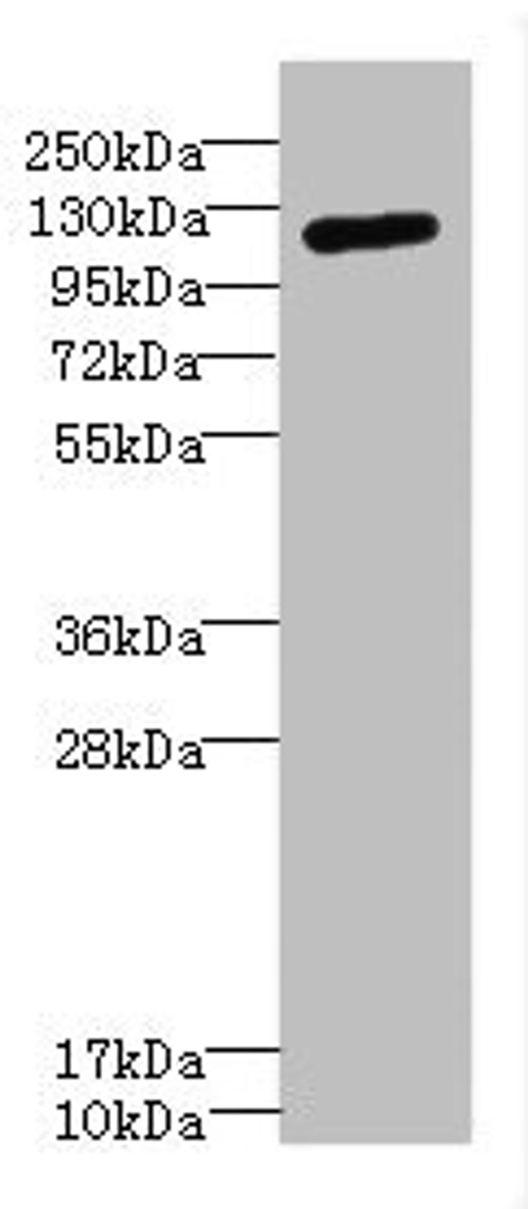 Western blot. All lanes: ITGAXantibody IgG at 1.59ug/ml + Mouse kidney tissue. Secondary. Goat polyclonal to rabbit IgG at 1/10000 dilution. Predicted band size: 128 kDa. Observed band size: 128 kDa. 
