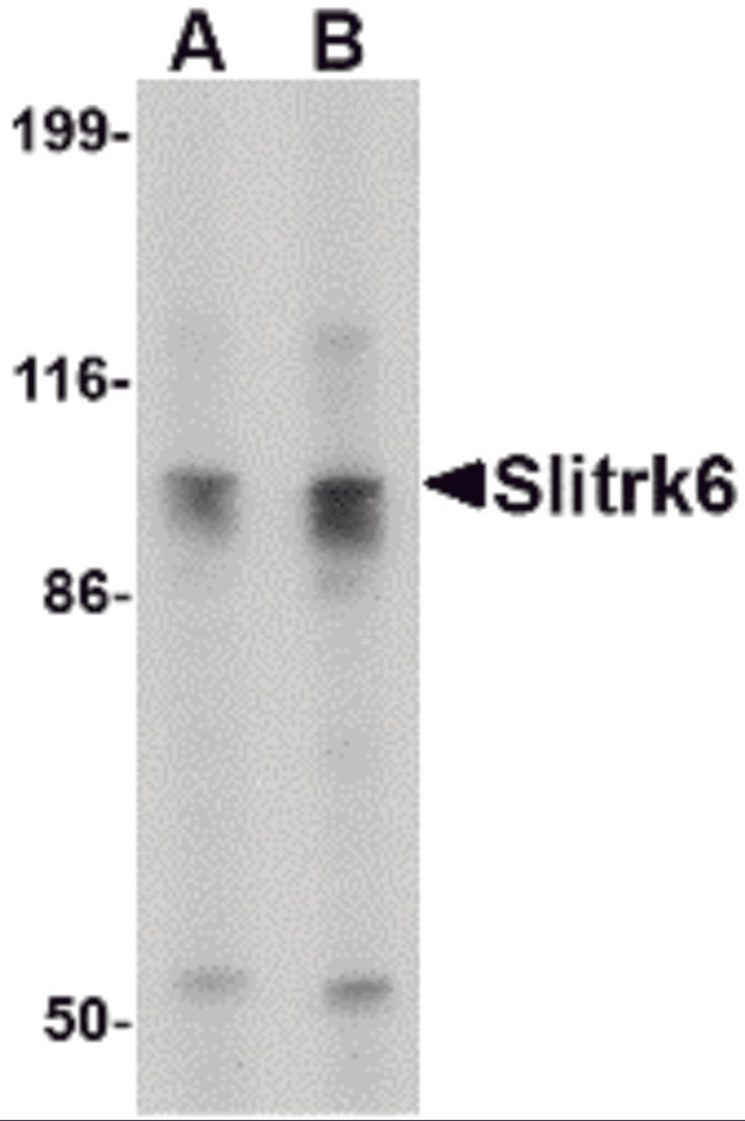 Western blot analysis of Slitrk6 in SK-N-SH cell lysate with Slitrk6 antibody at (A) 0.5 and (B) 1 &#956;g/mL.