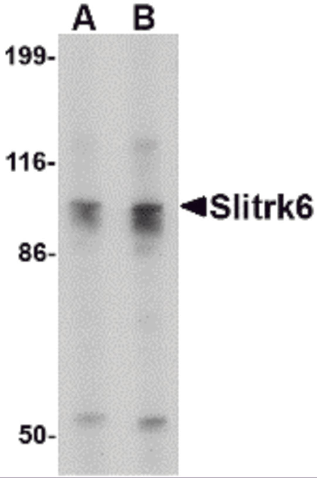 Western blot analysis of Slitrk6 in SK-N-SH cell lysate with Slitrk6 antibody at (A) 0.5 and (B) 1 μg/mL.