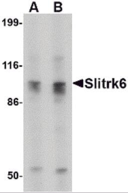 Western blot analysis of Slitrk6 in SK-N-SH cell lysate with Slitrk6 antibody at (A) 0.5 and (B) 1 μg/mL.