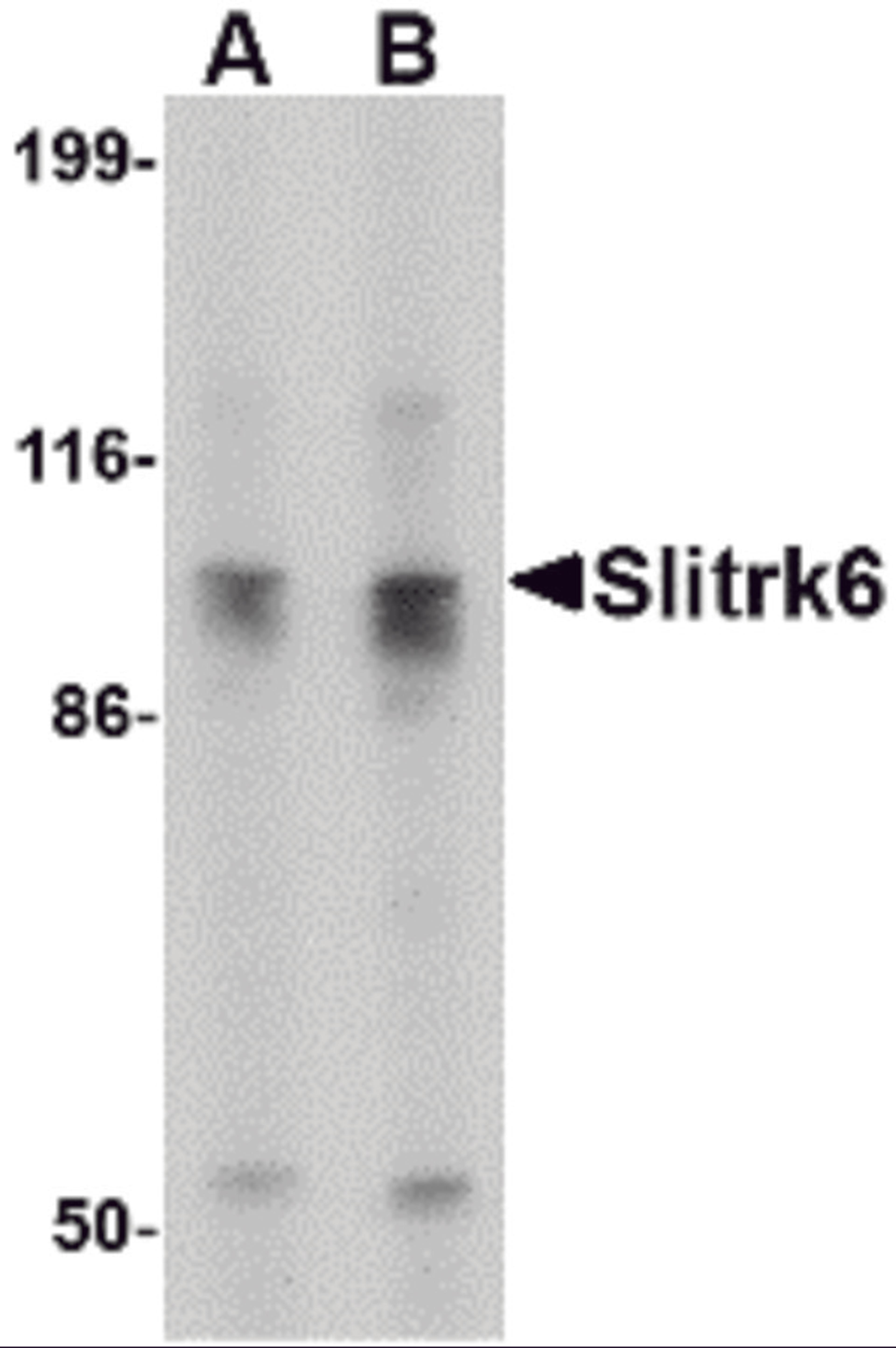 Western blot analysis of Slitrk6 in SK-N-SH cell lysate with Slitrk6 antibody at (A) 0.5 and (B) 1 μg/mL.