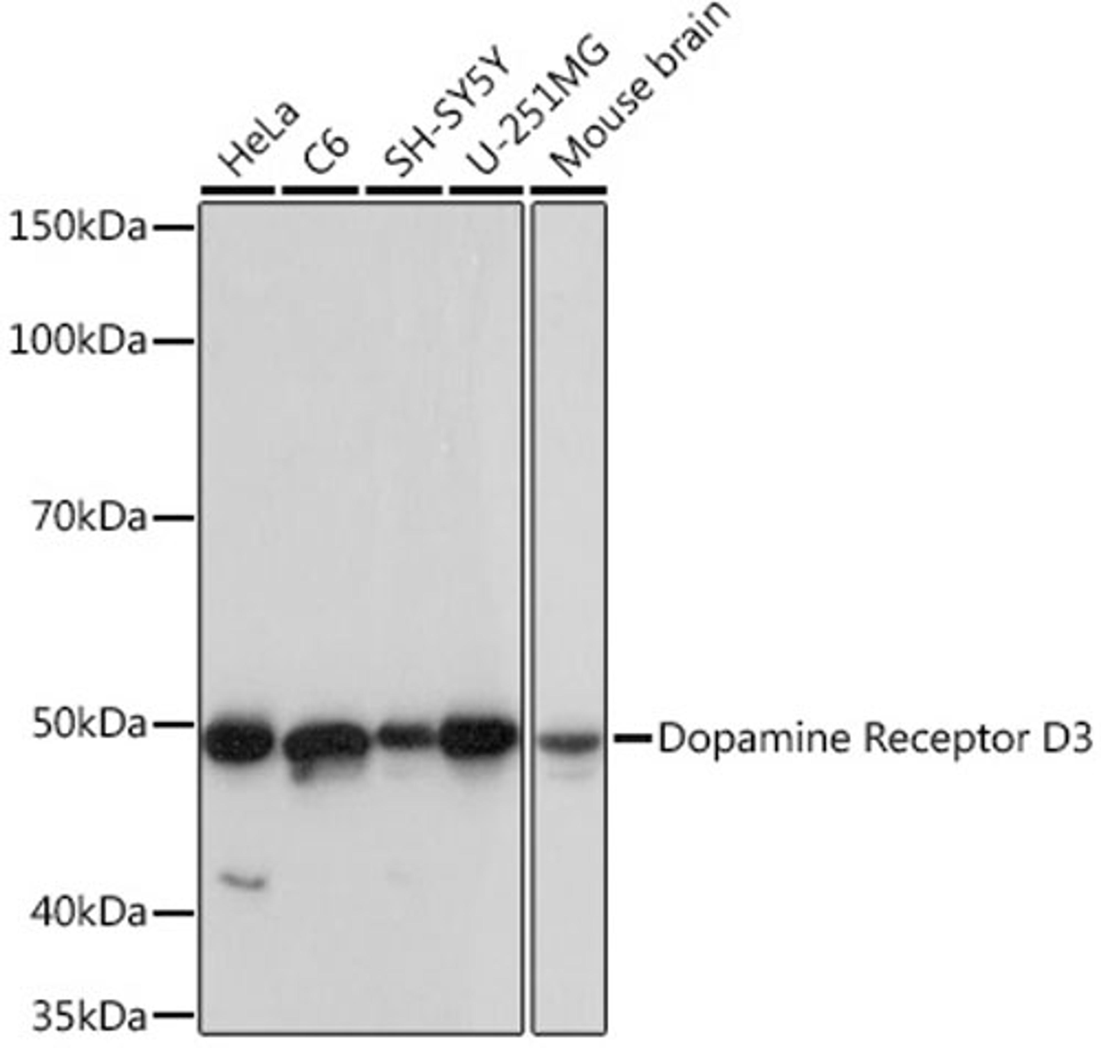 Western blot - Dopamine Receptor D3 Rabbit mAb (A4587)