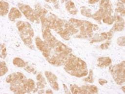 Detection of human COMT by immunohistochemistry.