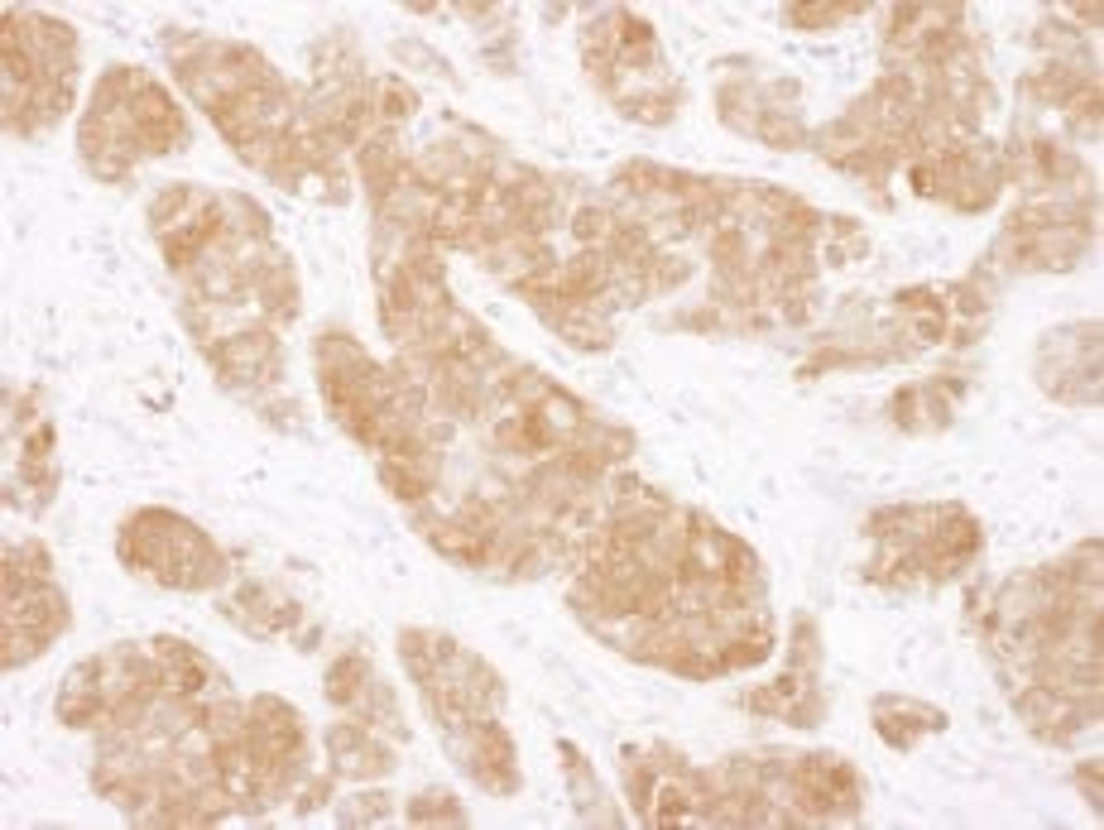 Detection of human COMT by immunohistochemistry.