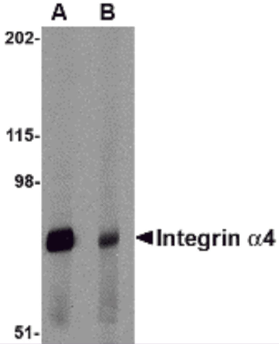 Western blot analysis of Integrin alpha 4 in rat spleen tissue lysate with Integrin alpha 4 antibody at 1 μg/mL in (A) the absence and (B) the presence of blocking peptide.