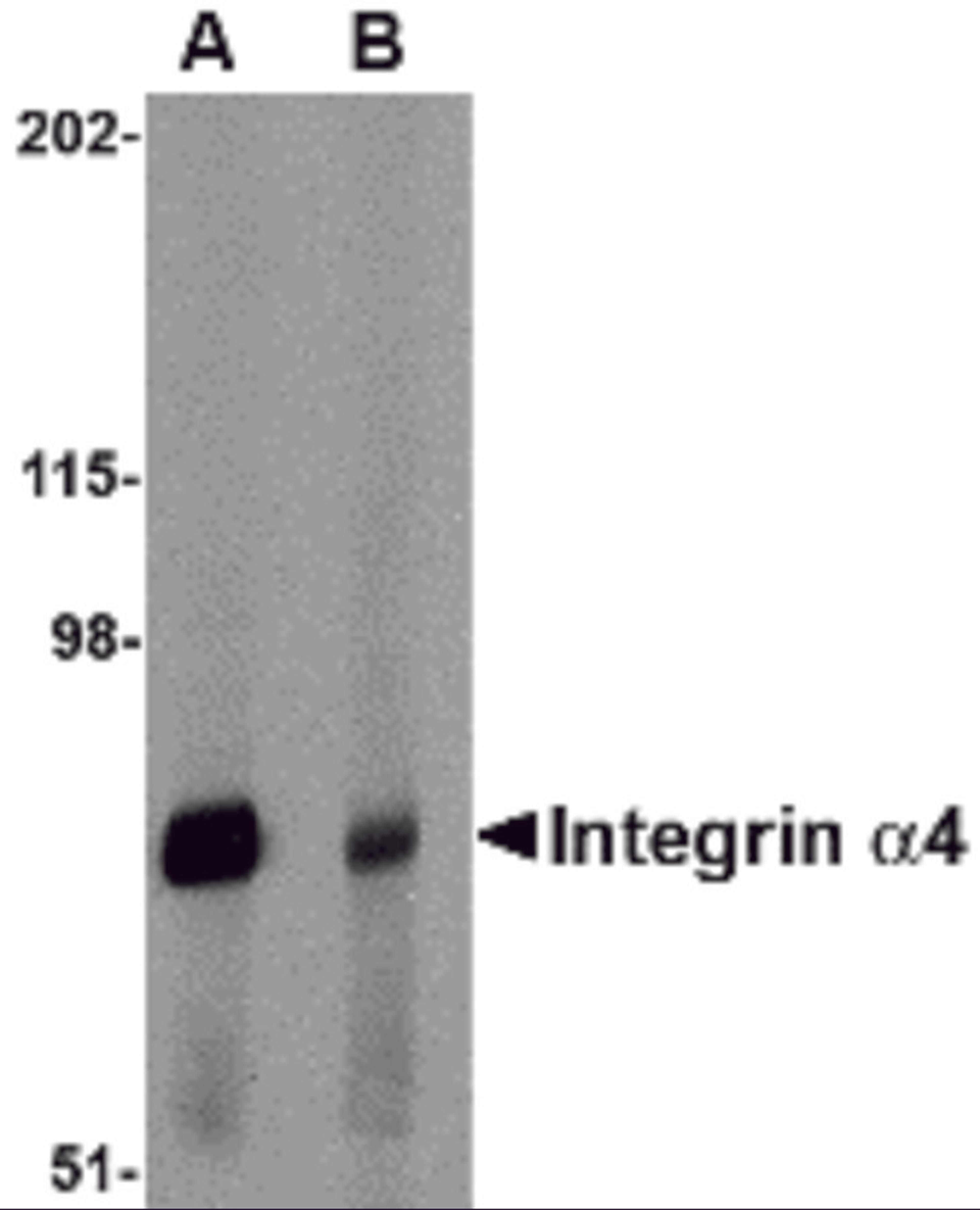 Western blot analysis of Integrin alpha 4 in rat spleen tissue lysate with Integrin alpha 4 antibody at 1 μg/mL in (A) the absence and (B) the presence of blocking peptide.