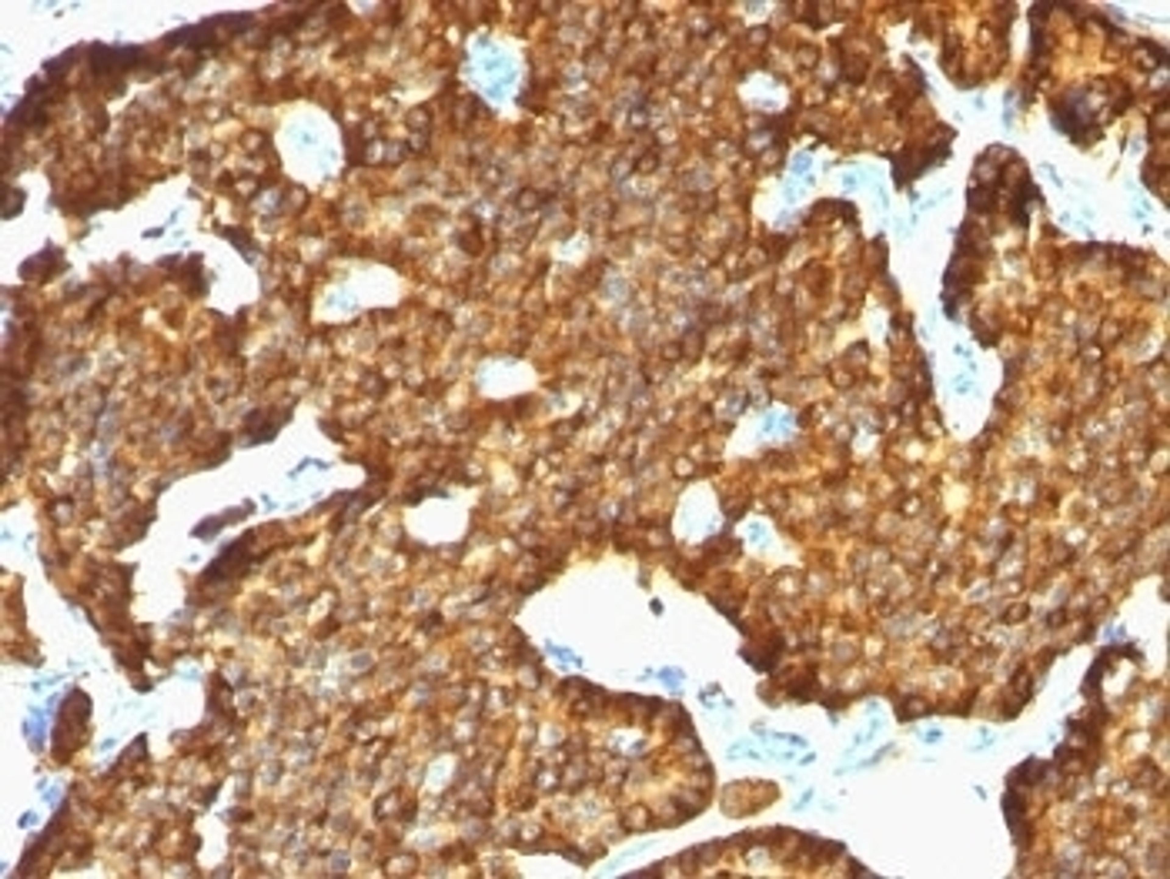 Formalin-fixed, paraffin-embedded human pancreas stained with Chromogranin A antibody (SPM553).