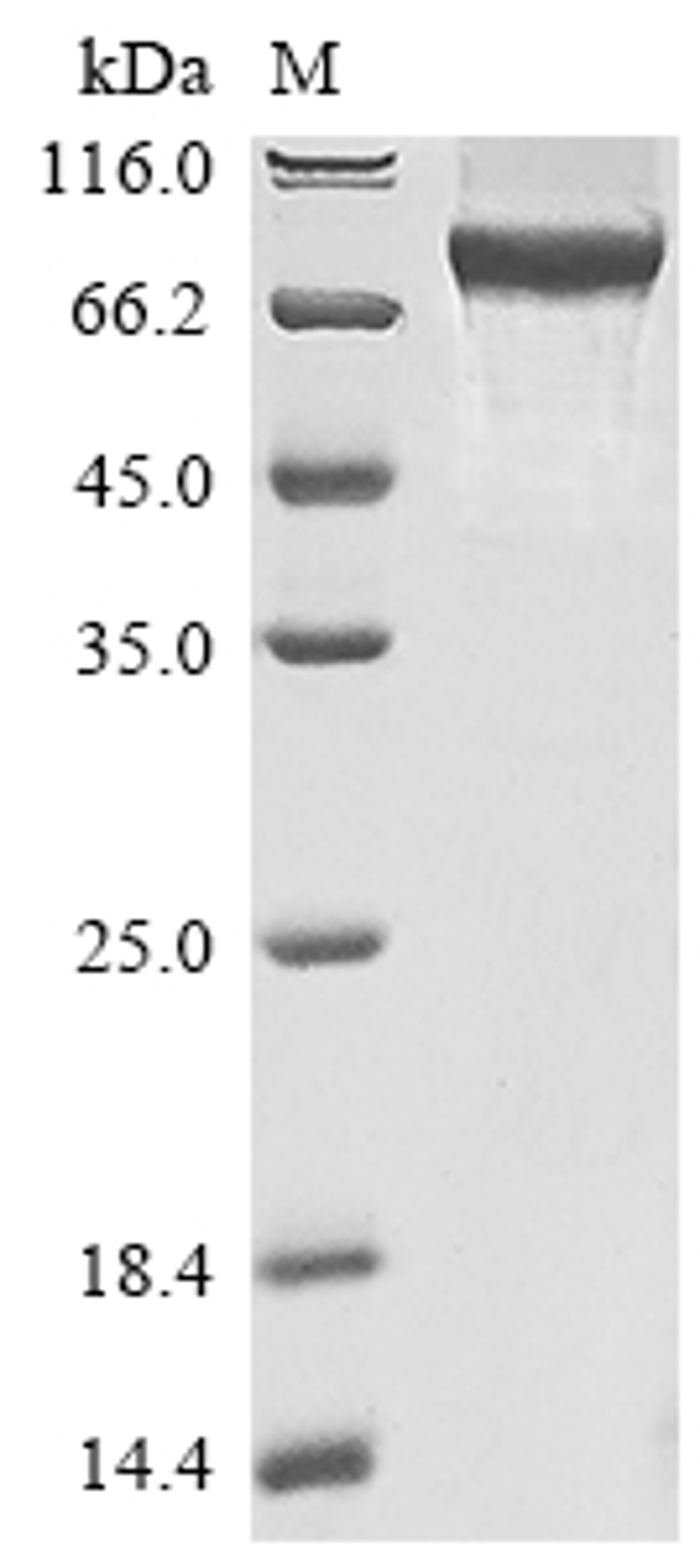 (Tris-Glycine gel) Discontinuous SDS-PAGE (reduced) with 5% enrichment gel and 15% separation gel.