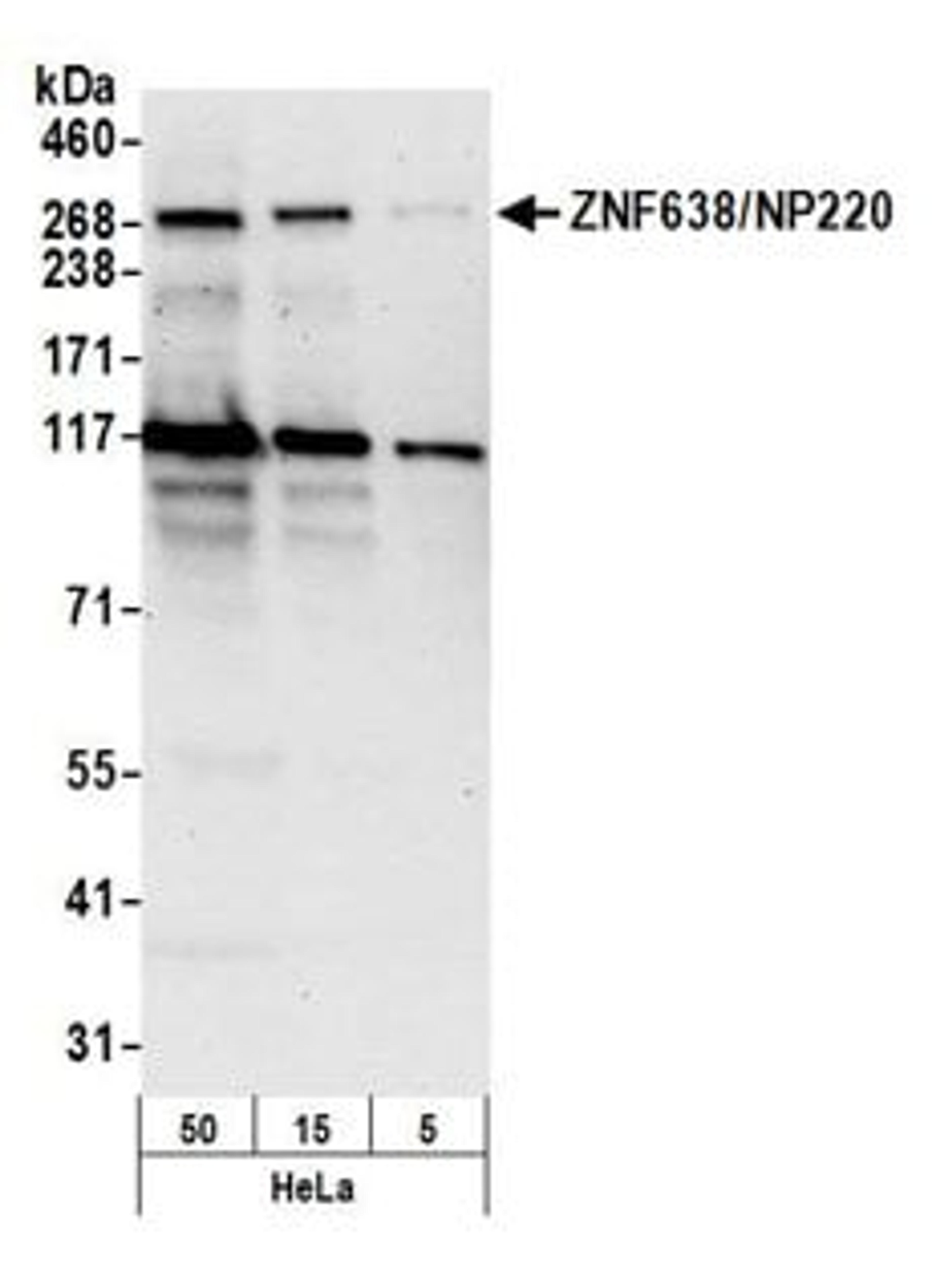 Detection of human ZNF638/NP220 by western blot.