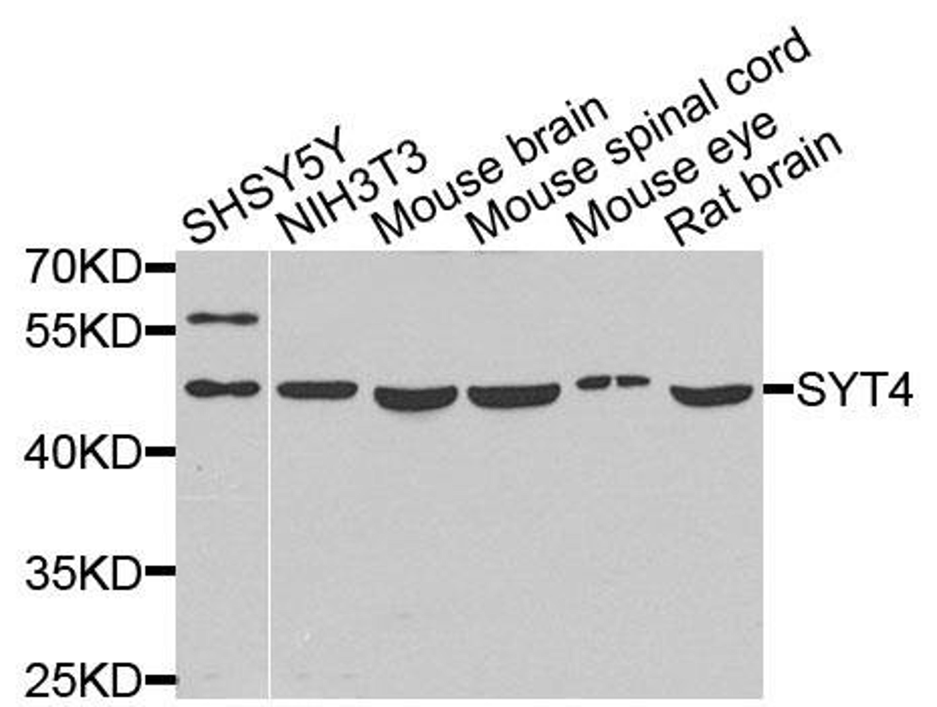 Western blot analysis of extracts of various cells using SYT4 antibody