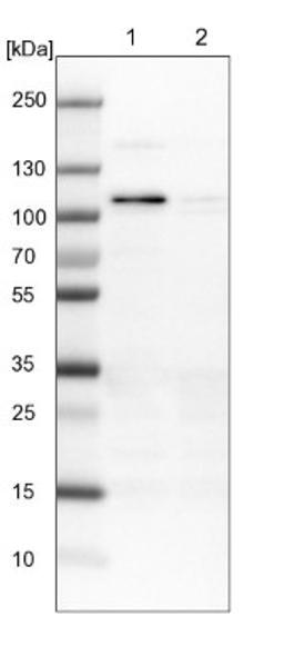 Western Blot: RASAL2 Antibody [NBP1-82578] - Lane 1: NIH-3T3 cell lysate (Mouse embryonic fibroblast cells)<br/>Lane 2: NBT-II cell lysate (Rat Wistar bladder tumour cells)