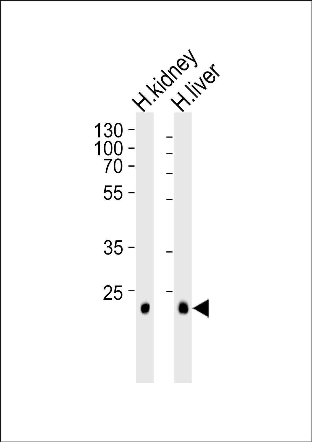 Western blot analysis of lysates from human kidney and liver tissue lysate (from left to right), using CLDN14 Antibody at 1:1000 at each lane.