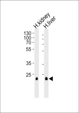 Western blot analysis of lysates from human kidney and liver tissue lysate (from left to right), using CLDN14 Antibody at 1:1000 at each lane.