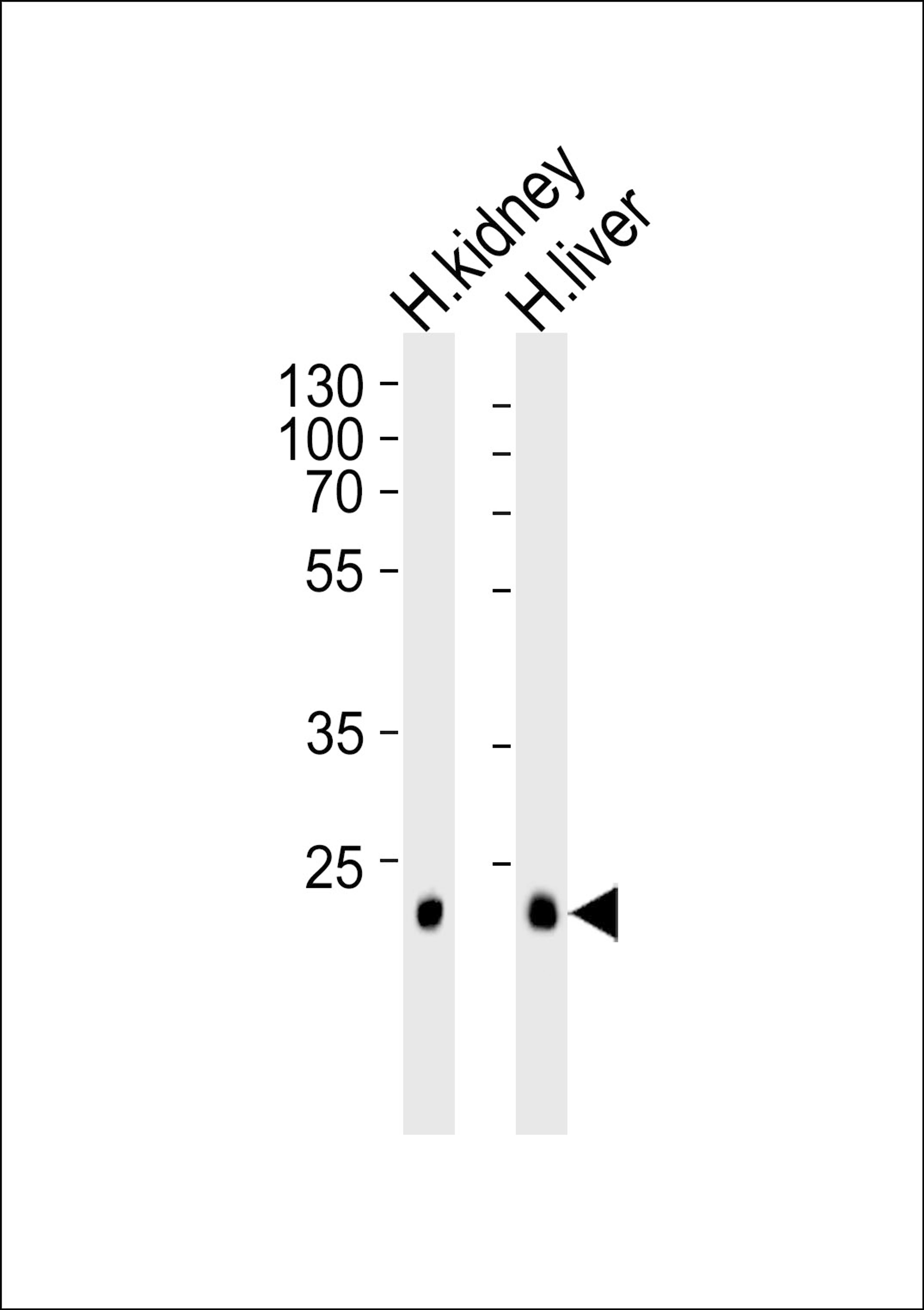 Western blot analysis of lysates from human kidney and liver tissue lysate (from left to right), using CLDN14 Antibody at 1:1000 at each lane.