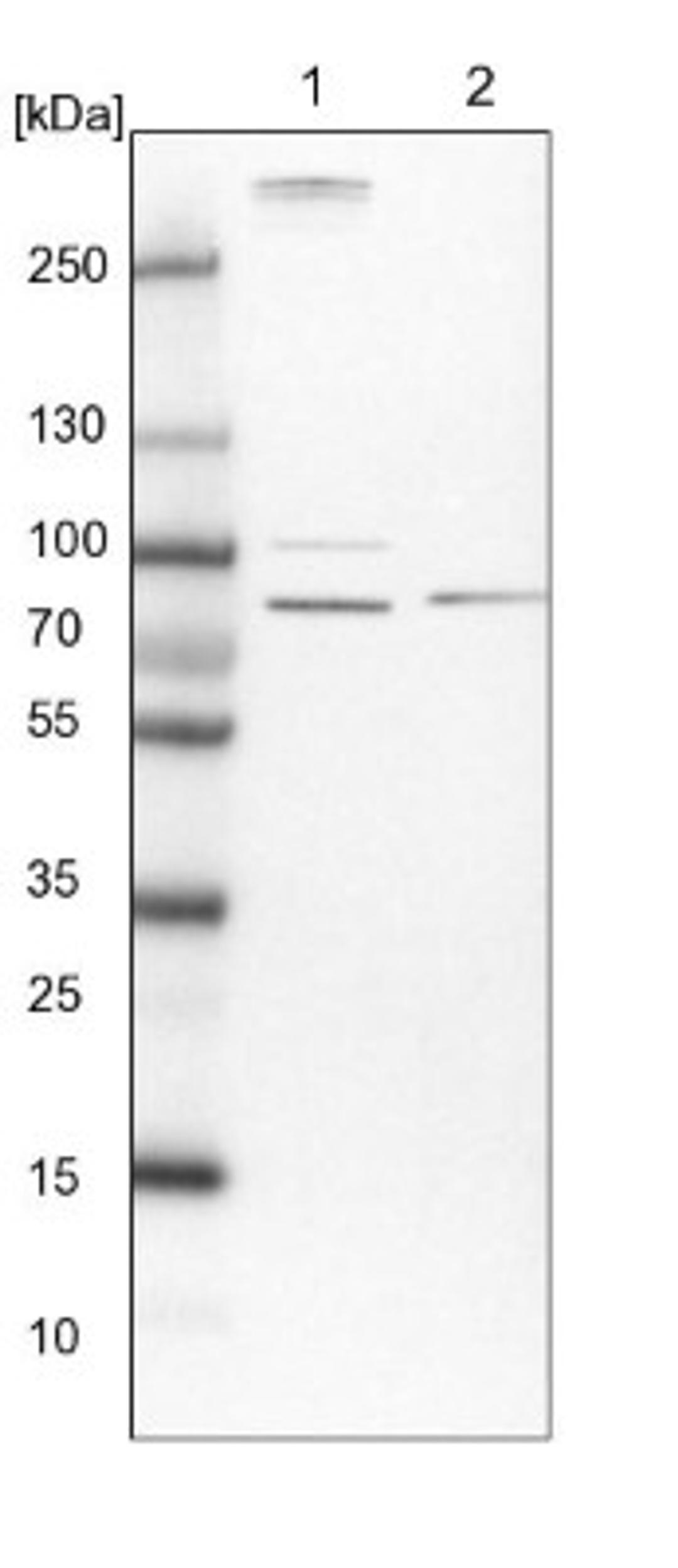 Western Blot: MAP4K5 Antibody [NBP1-83385] - Lane 1: NIH-3T3 cell lysate (Mouse embryonic fibroblast cells)<br/>Lane 2: NBT-II cell lysate (Rat Wistar bladder tumour cells)