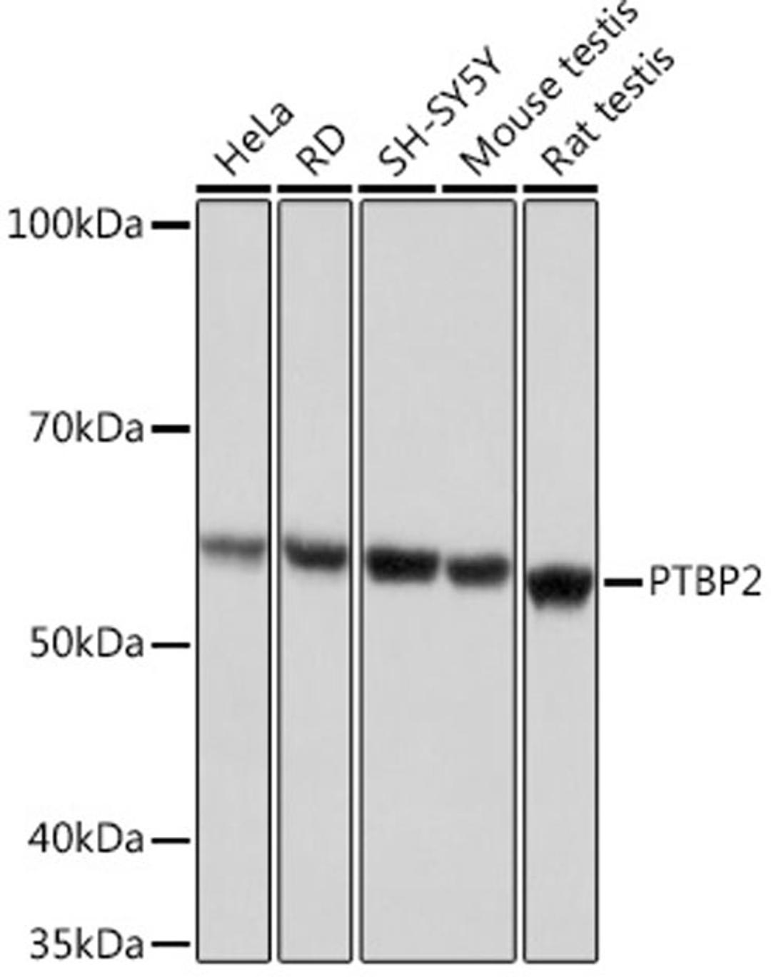 Western blot - PTBP2 Rabbit mAb (A9124)