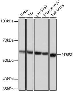 Western blot - PTBP2 Rabbit mAb (A9124)