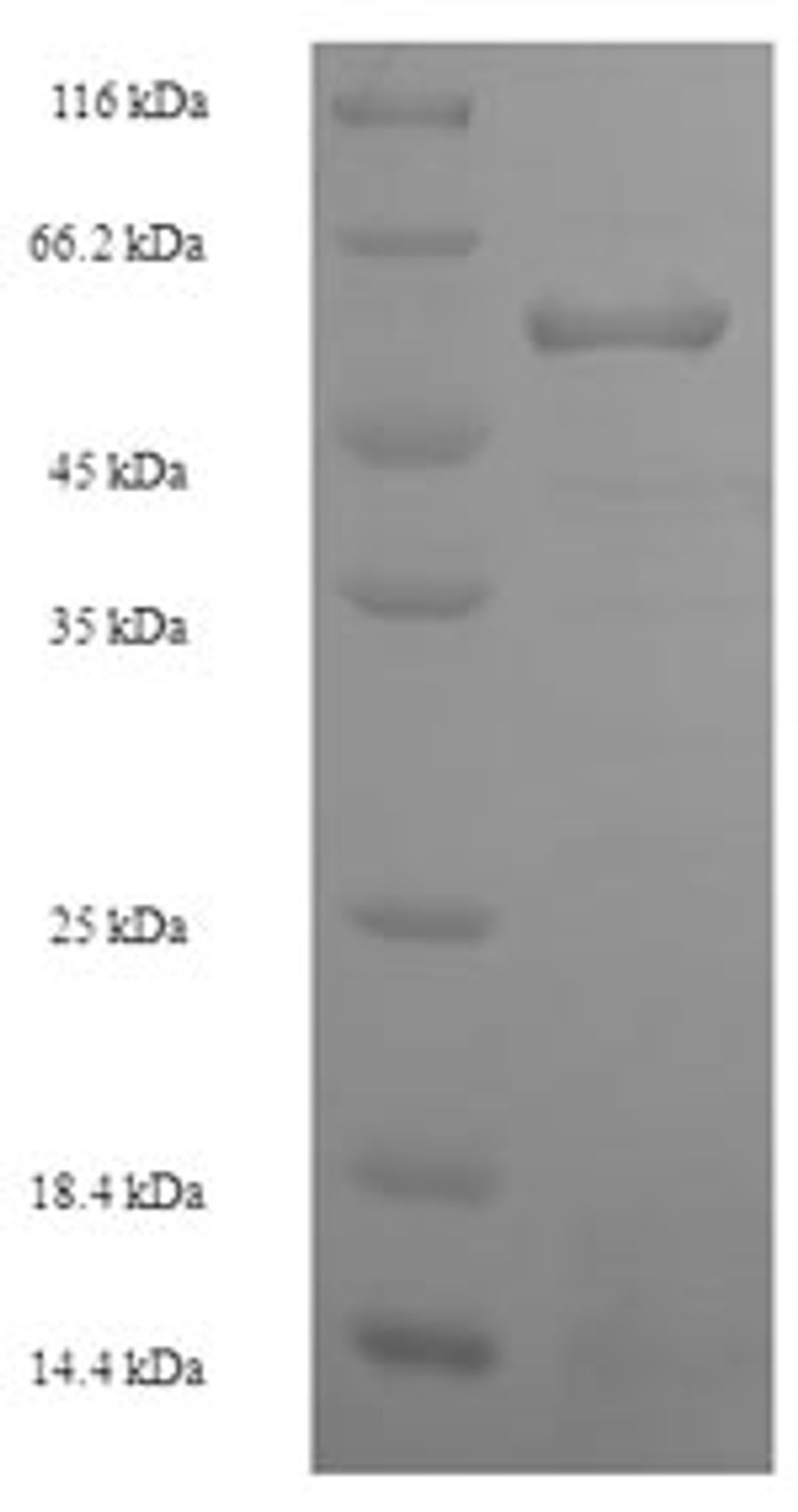 (Tris-Glycine gel) Discontinuous SDS-PAGE (reduced) with 5% enrichment gel and 15% separation gel.