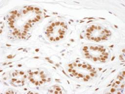 Detection of human ARS2 by immunohistochemistry.