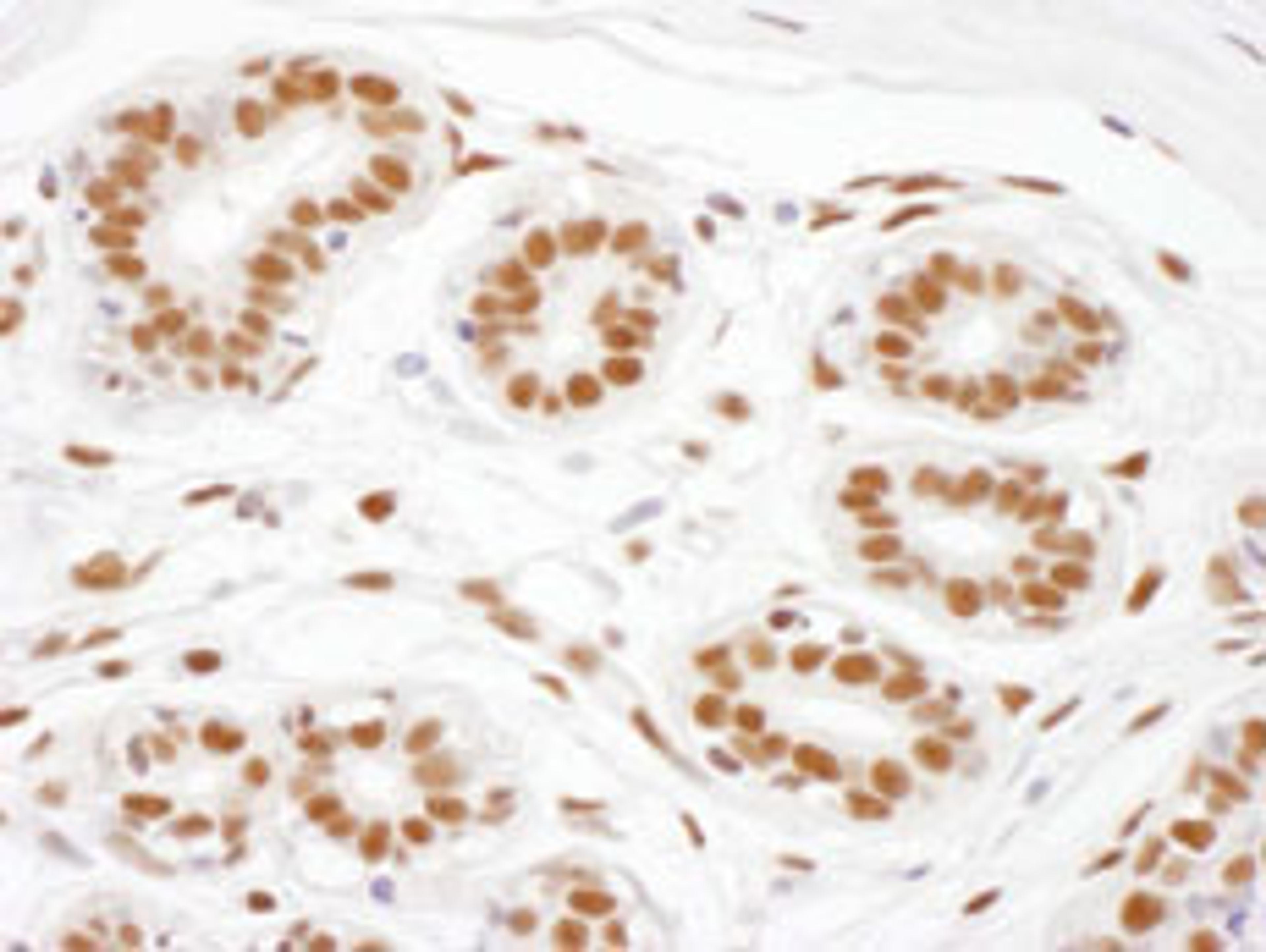 Detection of human ARS2 by immunohistochemistry.