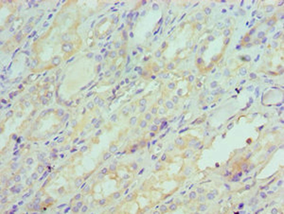 Immunohistochemistry of paraffin-embedded human kidney tissue using CSB-PA021062ESR2HU at dilution of 1:100
