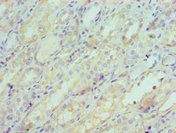 Immunohistochemistry of paraffin-embedded human kidney tissue using CSB-PA021062ESR2HU at dilution of 1:100