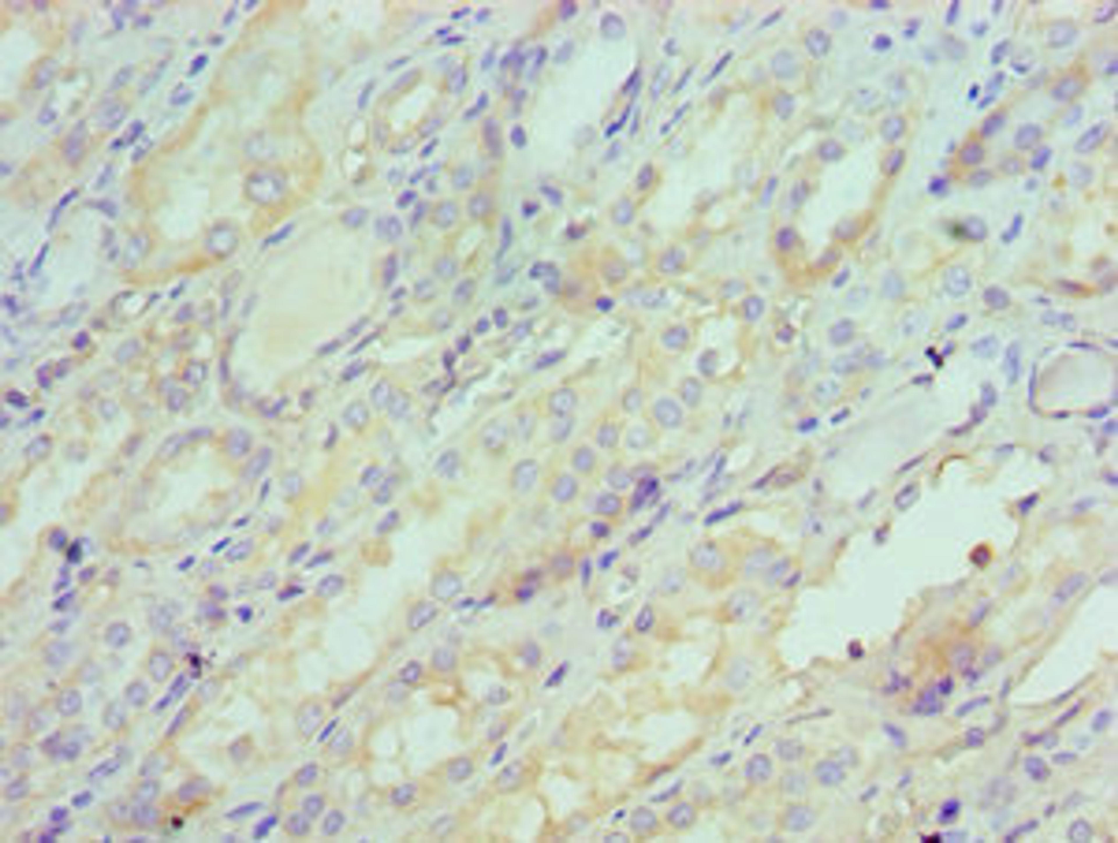 Immunohistochemistry of paraffin-embedded human kidney tissue using CSB-PA021062ESR2HU at dilution of 1:100