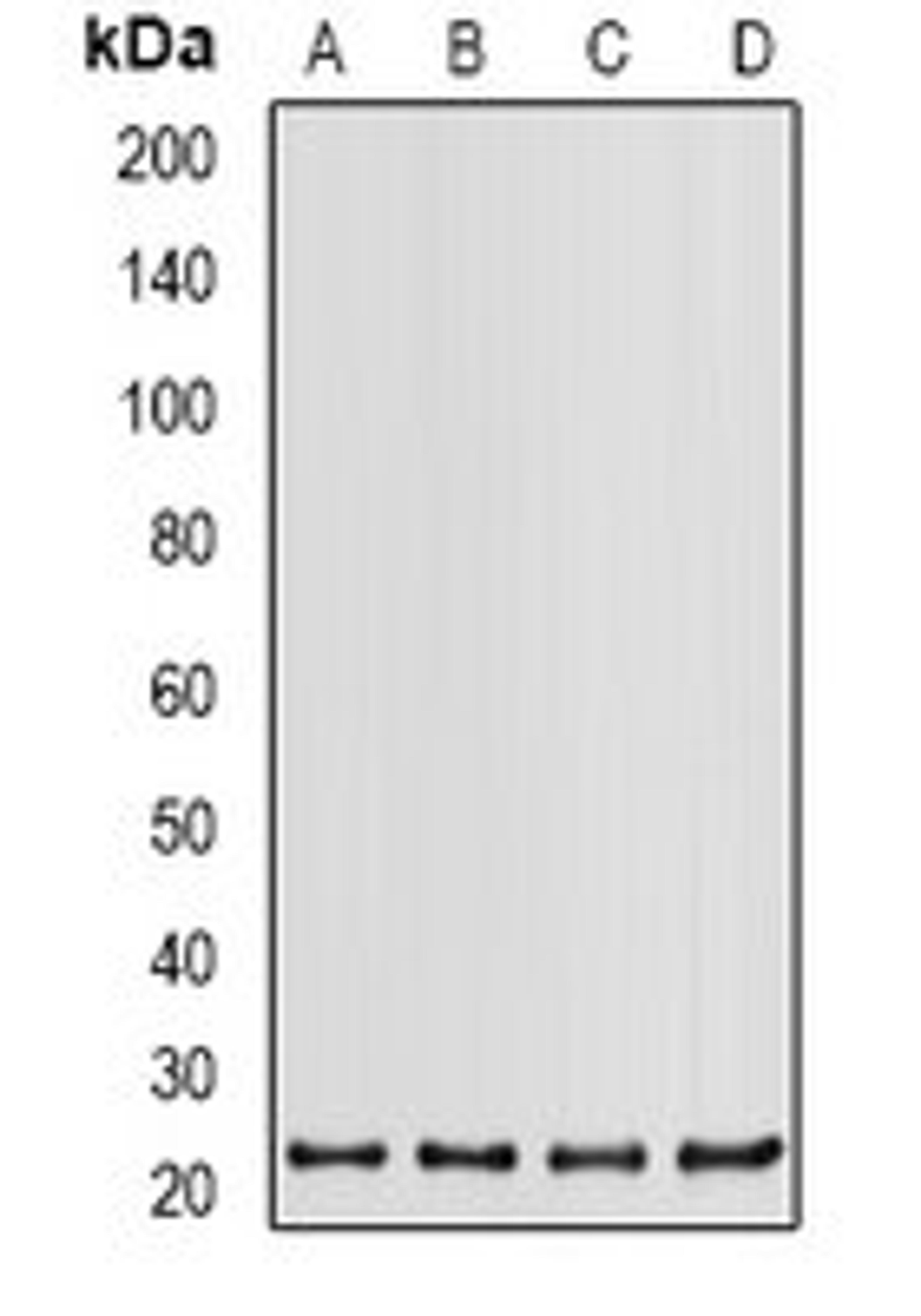 Western blot analysis of K562 (Lane1), HT29 (Lane2), Hela (Lane3), 22RV1 (Lane4) whole cell lysates using PSMB2 antibody