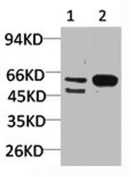 Western blot analysis of 1) Mouse Brain Tissue, 2)Rat Brain Tissue with GABA A Receptor α3 Rabbit pAb diluted at 1:2,000.