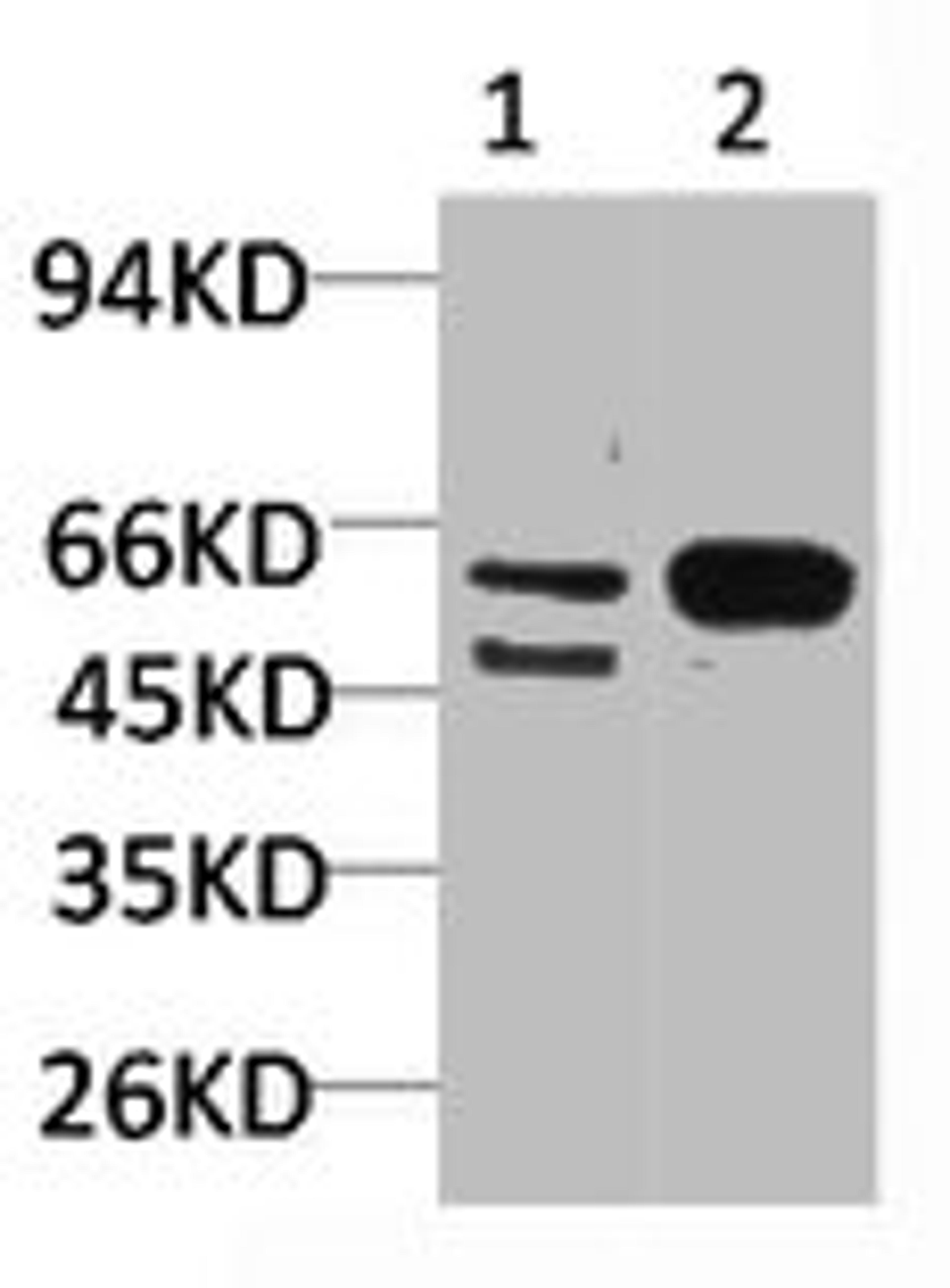 Western blot analysis of 1) Mouse Brain Tissue, 2)Rat Brain Tissue with GABA A Receptor α3 Rabbit pAb diluted at 1:2,000.