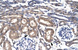 Antibody used in IHC on Human kidney lysate.