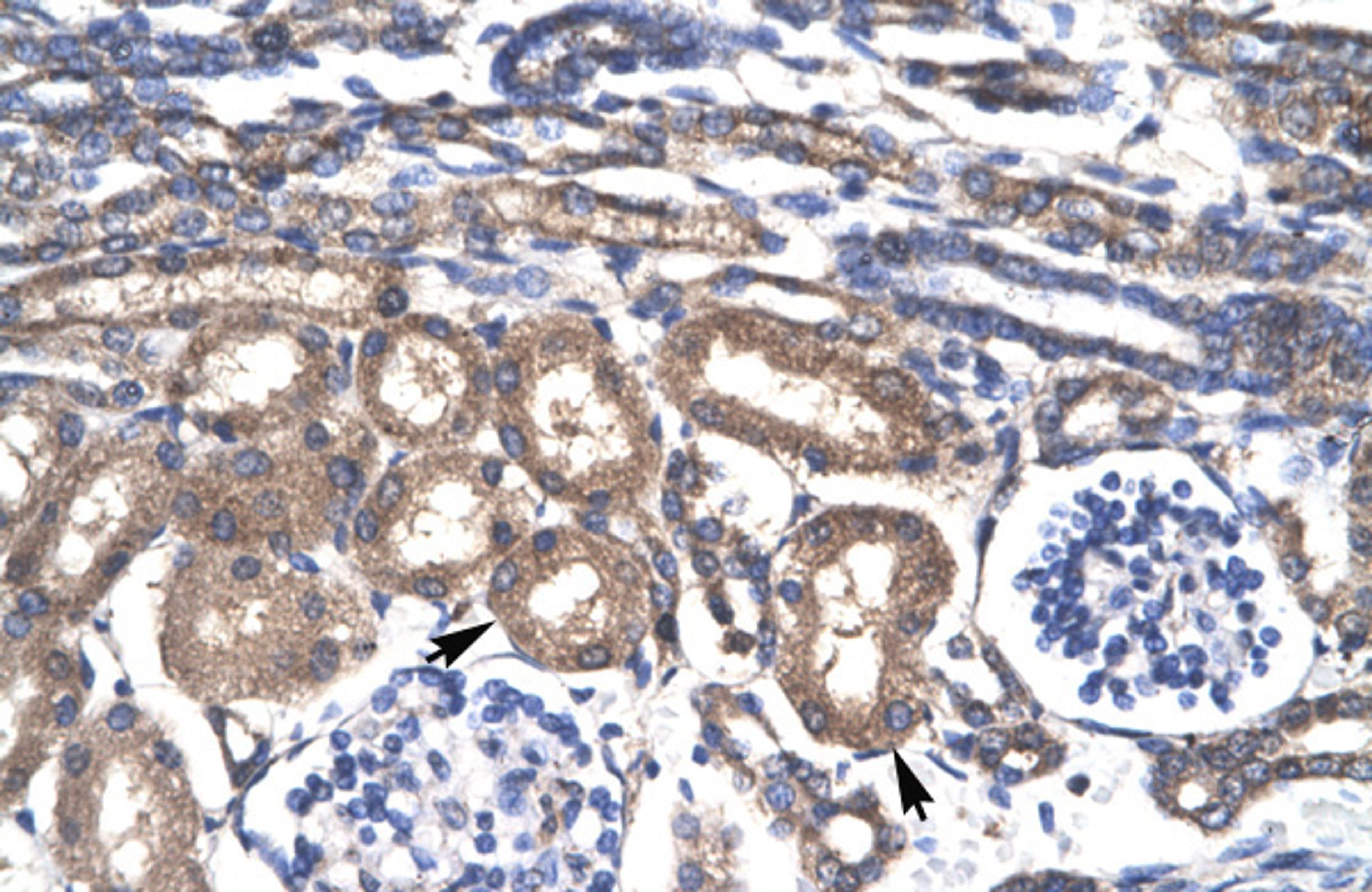 Antibody used in IHC on Human kidney lysate.