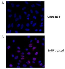 HeLa cells treated with BrdU (B) or untreated (A). Cells were stained with rabbit anti-BrdU antibody