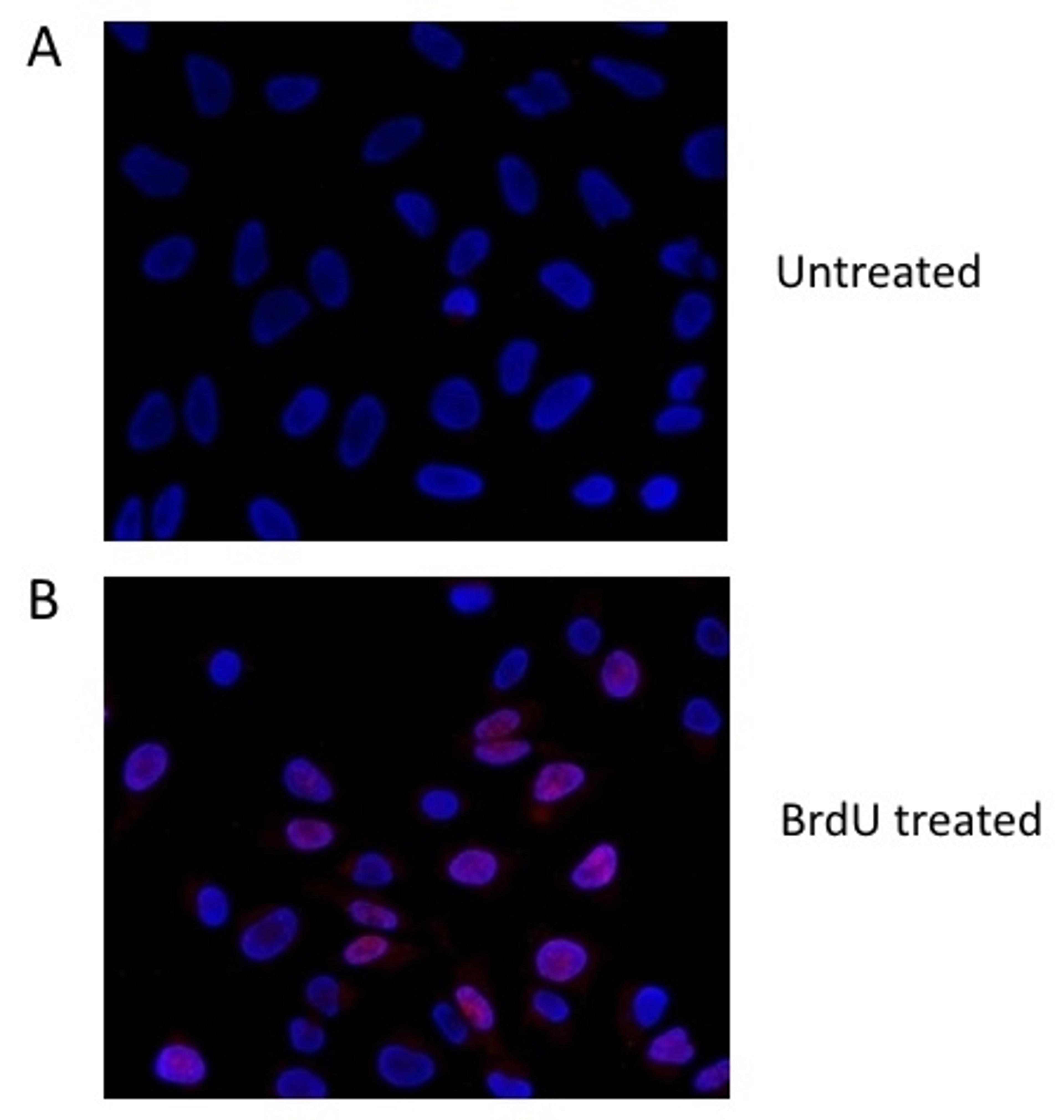 HeLa cells treated with BrdU (B) or untreated (A). Cells were stained with rabbit anti-BrdU antibody