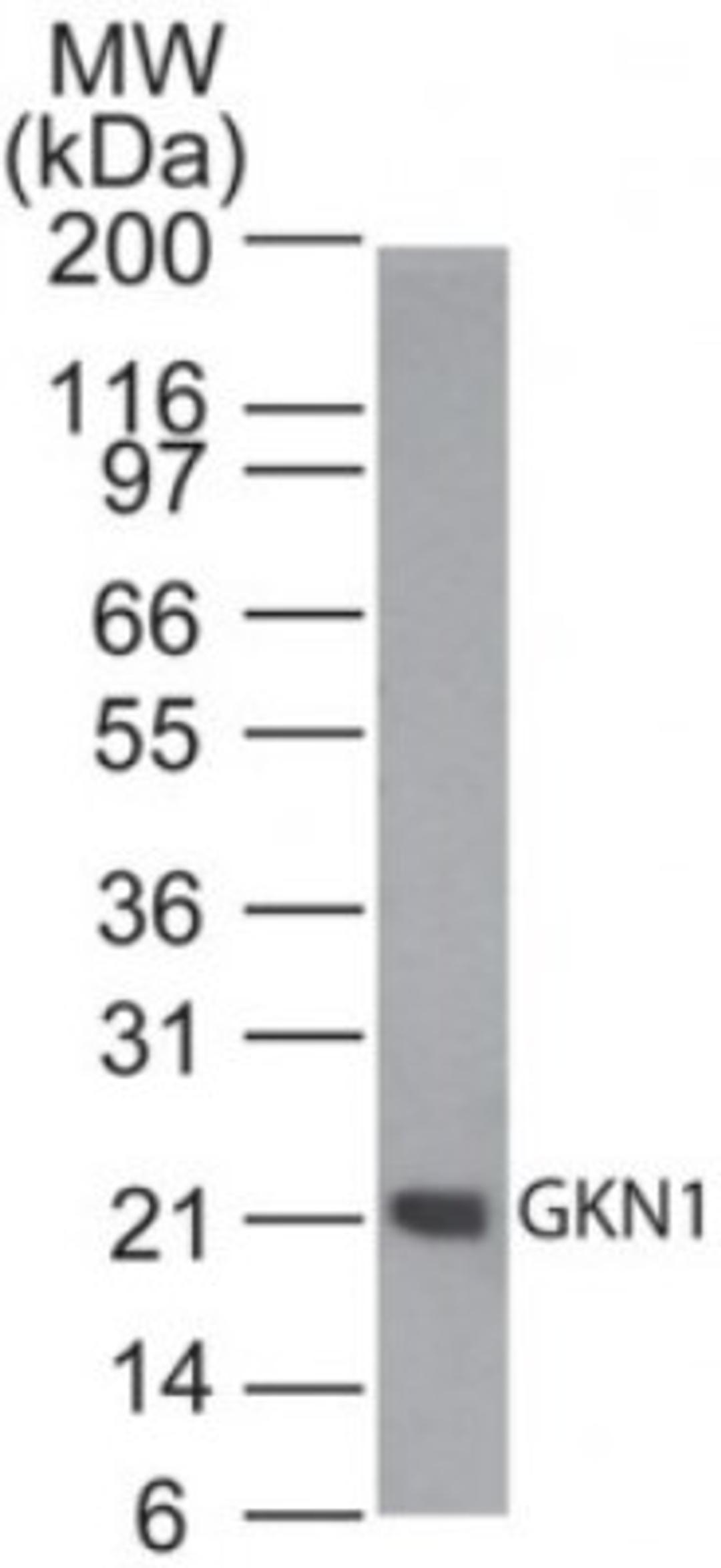 Western Blot: Gastrokine 1 Antibody [NBP2-24766] - Analysis of GKN1 in human stomach tissue lysate using this antibody. 1 ug/ml. Goat anti-rabbit Ig HRP secondary antibody and PicoTect ECL substrate solution were used for this test.