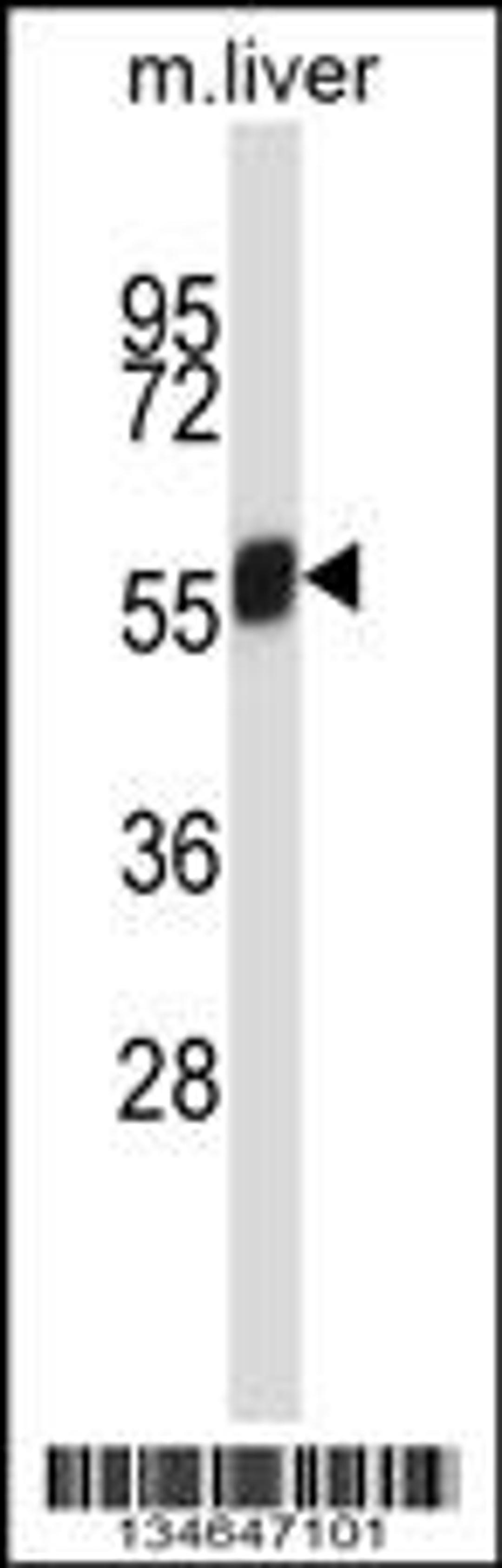 Western blot analysis in mouse liver tissue lysates (35ug/lane).