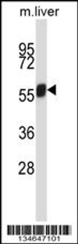 Western blot analysis in mouse liver tissue lysates (35ug/lane).