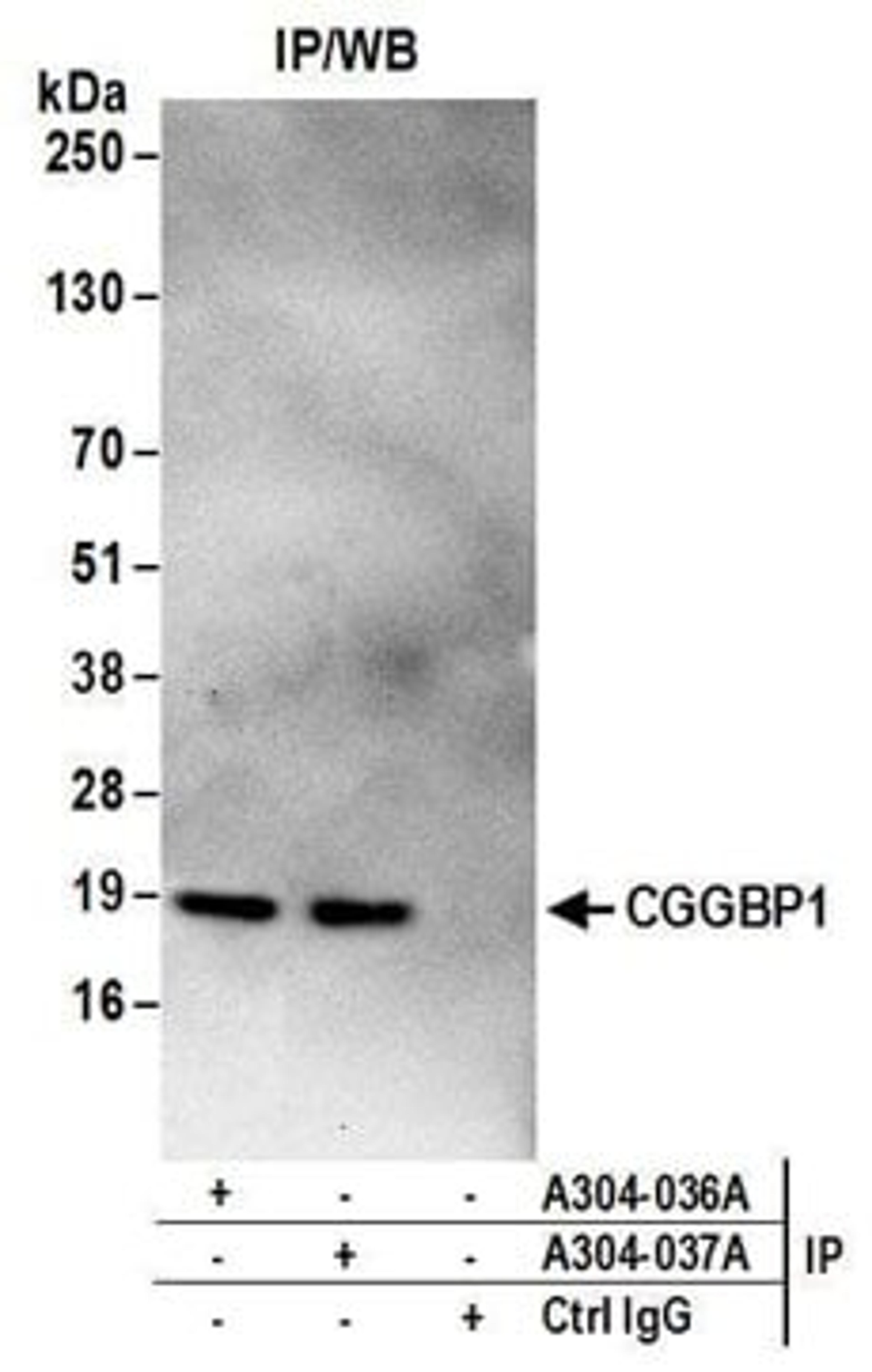 Detection of human CGGBP1 by western blot of immunoprecipitates.