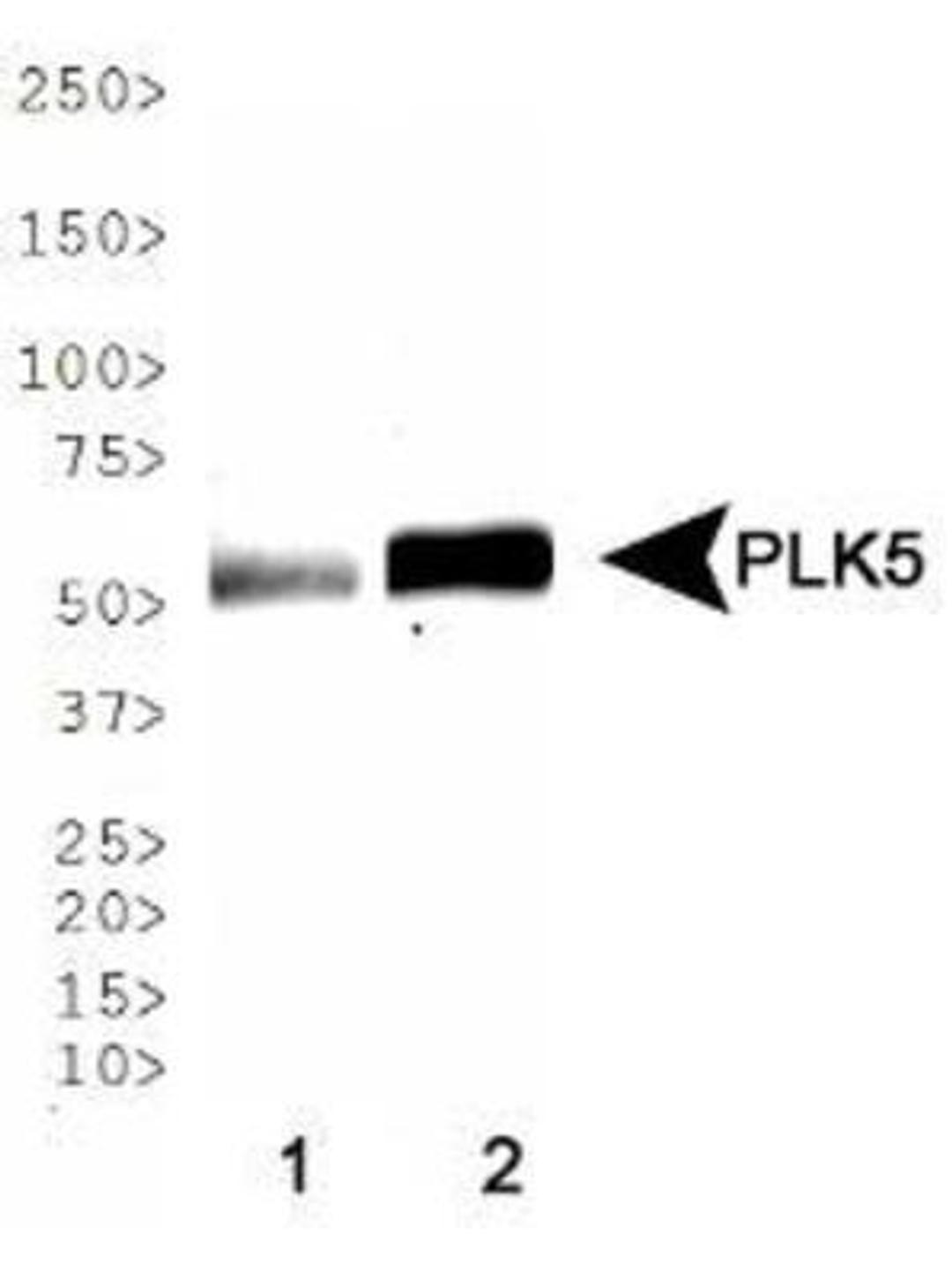 Western Blot: PLK5 Antibody [NBP1-97306] - WB analysis of PLK5 in 1. human brain lysate and 2. mouse brain lysate. Molecular weight of PLK5 differs between human and mouse species.