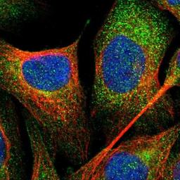 Immunocytochemistry/Immunofluorescence: KIF12 Antibody [NBP1-85984] - Immunofluorescent staining of human cell line U-2 OS shows positivity in vesicles.