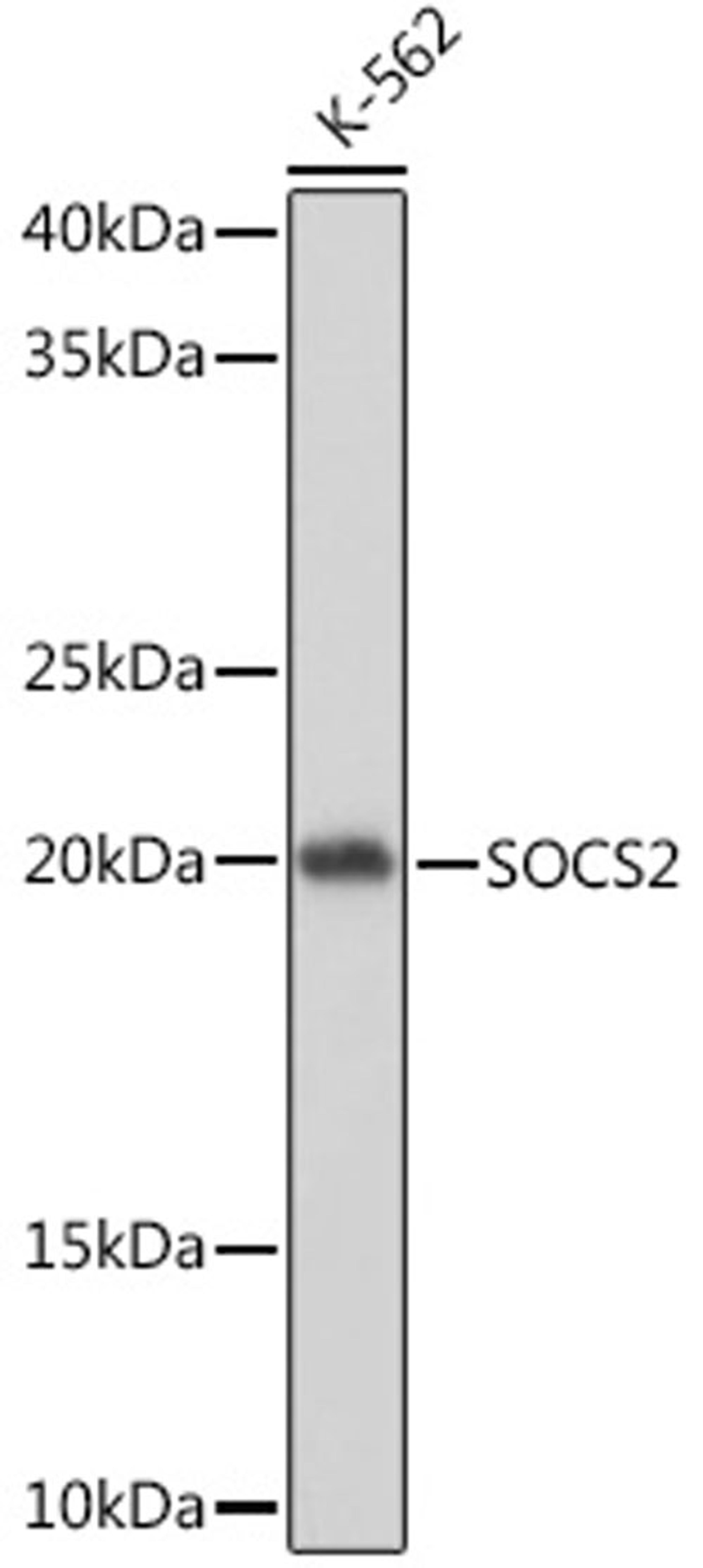 Western blot - SOCS2 Rabbit mAb (A9190)