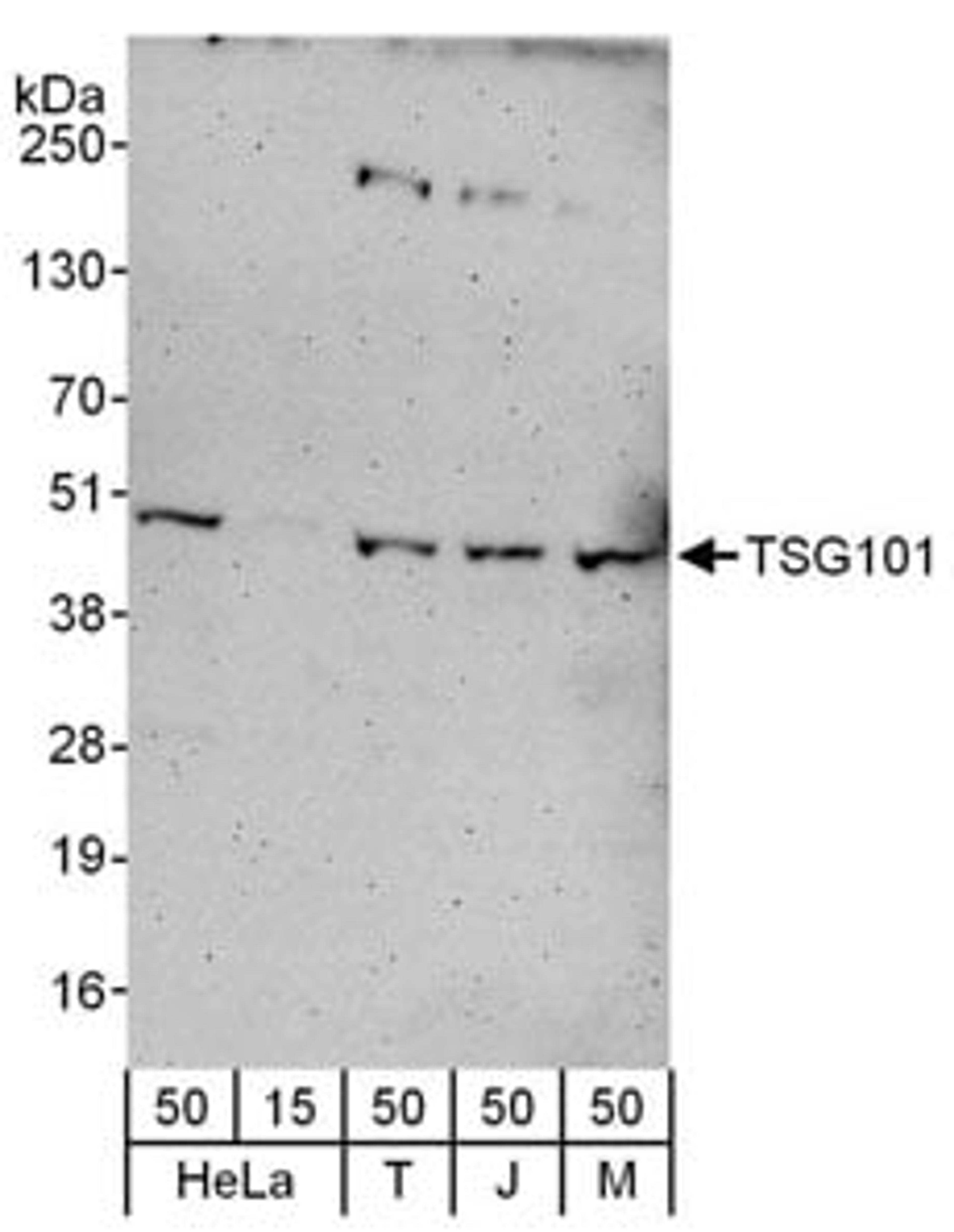 Detection of human and mouse TSG101 by western blot.