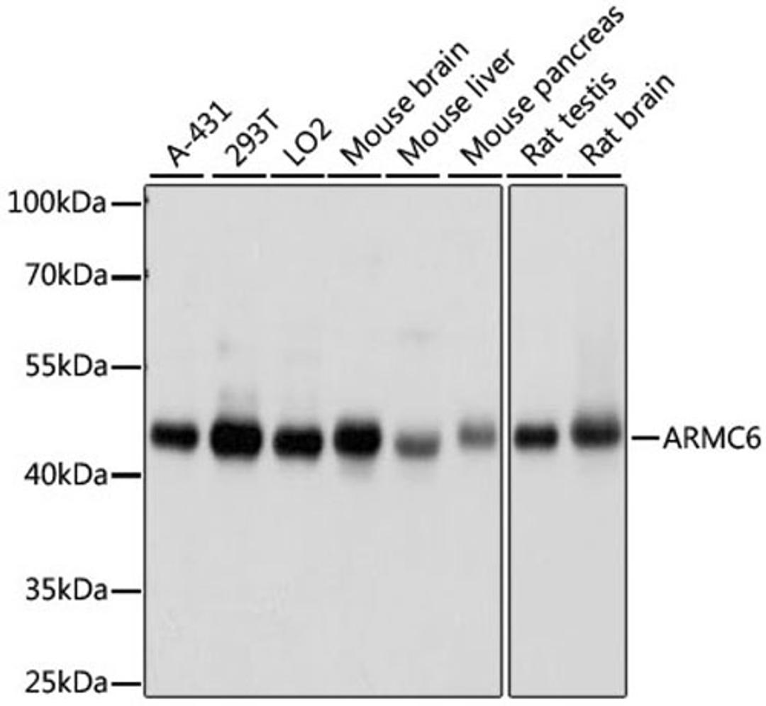 Western blot - ARMC6 antibody (A15931)