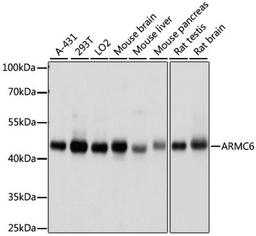 Western blot - ARMC6 antibody (A15931)